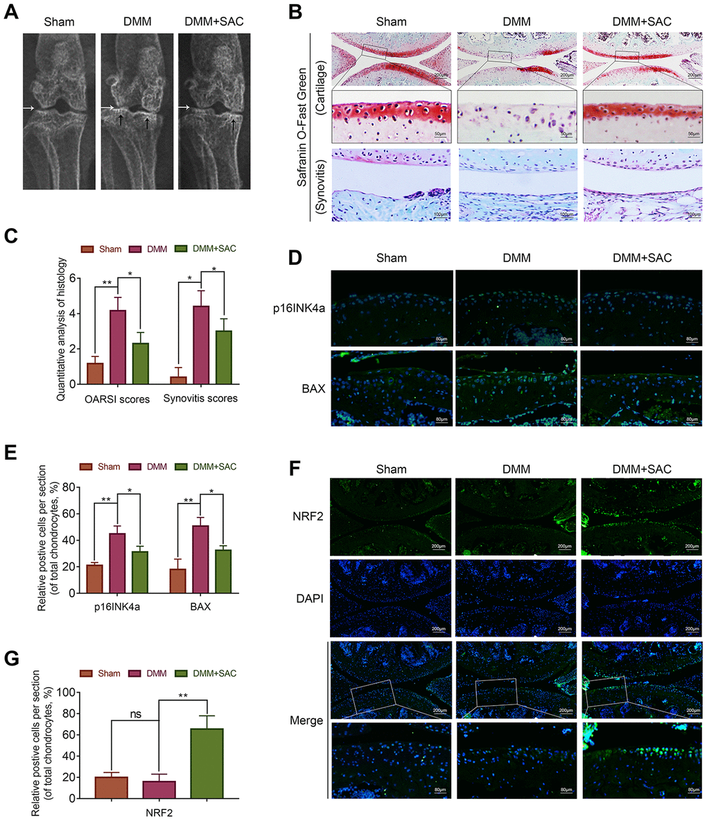 SAC ameliorates in vivo osteoarthritis progression in the DMM model mice. (A) Representative X-ray images show the knee joints of mice belonging to sham, DMM and DMM+SAC groups. The white arrows show the narrowing of the joint space in both the DMM and DMM+SAC mice, and the black arrows show the calcification of cartilage surface in the DMM group. (B) Representative images show the S-O staining of cartilage and synovitis in the knee joint sections from mice belonging to sham, DMM and DMM+SAC groups at 8-weeks post-surgery. Scale bar: 200, 50 or 100 μm. (C) The OARSI scores of cartilage damage and synovitis scores for the mice belonging to sham, DMM and DMM+SAC groups at 8-weeks post-surgery are shown. (D, F) Representative immunohistochemical staining images (Scale bar: 200 or 80 μm) and (E, G) Histogram plots show the levels of p16INK4a, BAX and Nrf2 proteins in the cartilage sections of mice belonging to the sham, DMM and DMM+SAC groups at 8-weeks post-surgery. Note: The data are presented as the means ± SD of five independent experiments. *p p p 