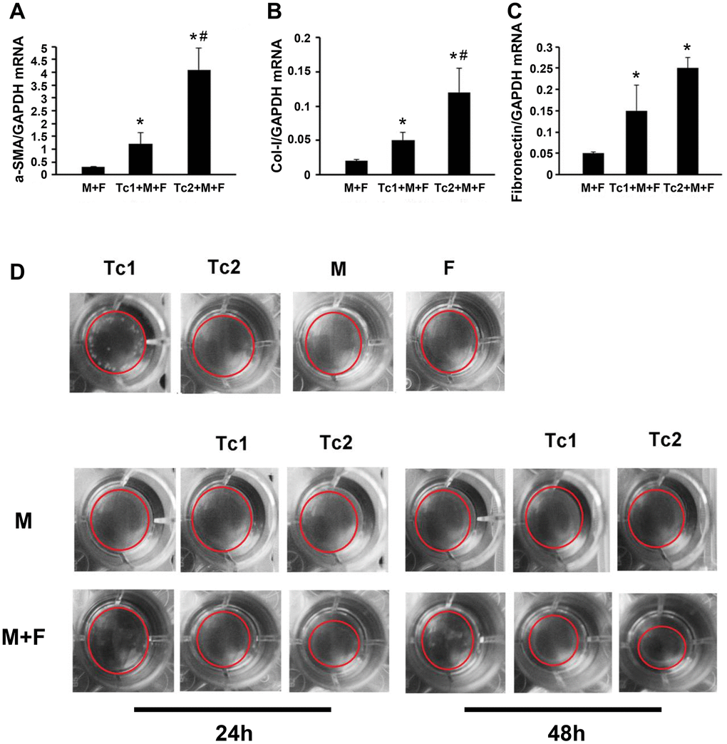 Tc2-treated macrophages promoted the differentiation of fibroblasts to myofibroblasts more than Tc1. (A–C) NIH3T3 cells cocultured with Raw264.7 cells, Tc1 plus Raw264.7 cells, or Tc2 plus Raw264.7 cells were collected through cell sorting for mRNA examination (*p D) NIH3T3 cells were cocultured for 24 and 48 h with Raw264.7 cells plus Tc1 or Tc2 to assay cell contraction assay by using a cell contraction assay kit. Changes in gel size were indicated by red circles.