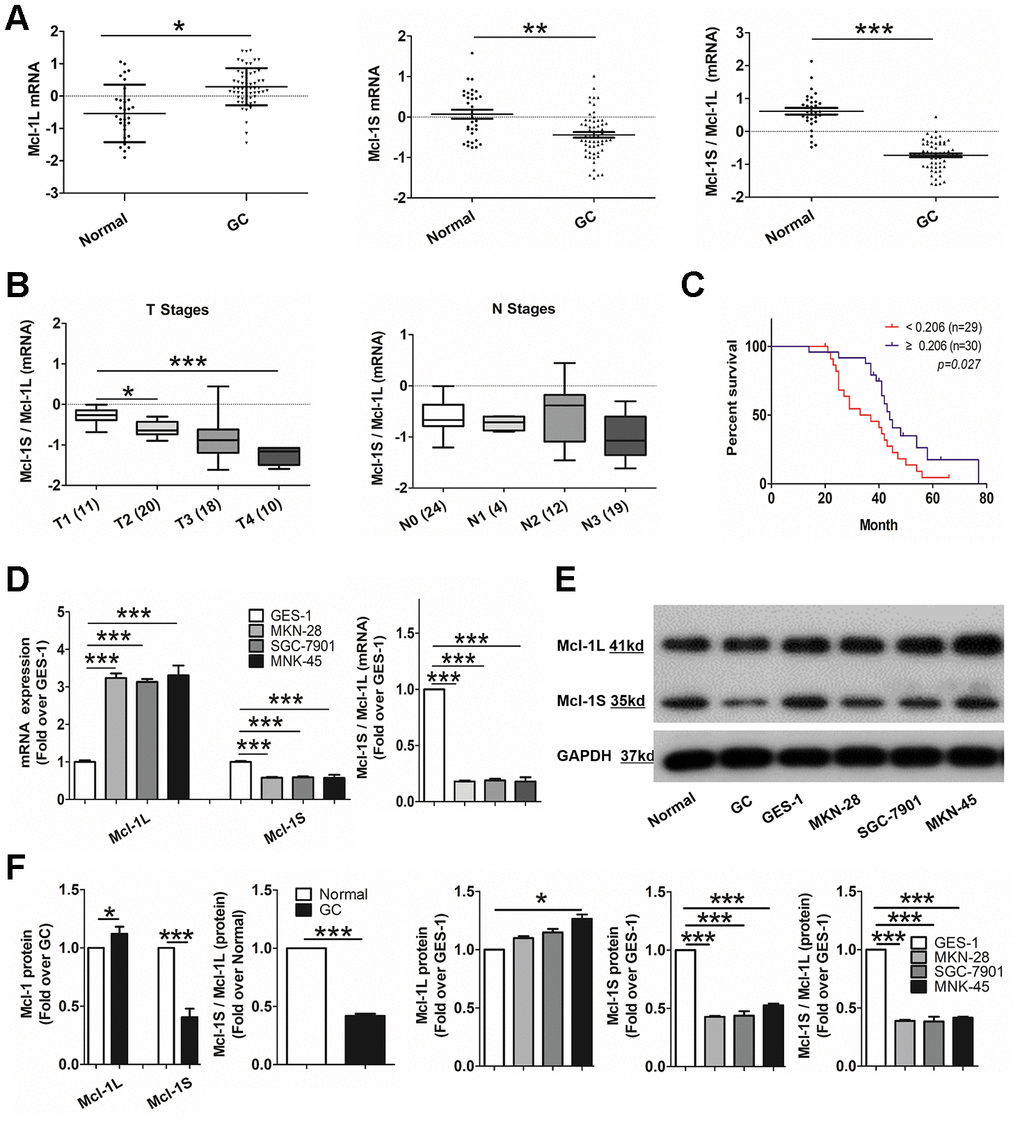 Up-regulated myeloid cell leukemia (Mcl)-1L and down-regulated Mcl-1S expression is correlated with tumor proliferation and poor survival in human gastric cancer (GC). (A) Comparison of Mcl-1L and Mcl-1S messenger RNA (mRNA) expression between GC and normal tissues was performed. Dot plots represent Mcl-1L and Mcl-1S mRNA expression levels and Mcl-1S/Mcl-1L ratios in 59 GC samples and 31 healthy tissues. Mcl-1L and Mcl-1S expression was normalized to glyceraldehyde 3-phosphate dehydrogenase expression. Data are presented after logarithmic transformation as the mean ± standard deviation (SD). *p B) The Mcl-1S/Mcl-1L mRNA ratios in cells in different T or N stages of the TNM staging system are presented. Data are shown after logarithmic transformation. (C) Kaplan–Meier survival curves for 59 individuals grouped based on the median value of Mcl-1S/Mcl-1L are shown. (D) Increased Mcl-1L and decreased Mcl-1S mRNA expression levels and Mcl-1S/Mcl-1L values in GC cell lines, compared with in the GES-1 cell line, are shown. mRNA expression was normalized by the 2-ΔΔCt method. Data are shown as the means ± SD. (E) Western blot showing decreased Mcl-1S protein levels and Mcl-1S/Mcl-1L in GC tissues and cell lines is shown. (F) Increased Mcl-1L and decreased Mcl-1S protein expression levels and Mcl-1S/Mcl-1L values in GC cell lines, compared with those in the GES-1 cell line, are shown. Data are shown as the means ± SD.