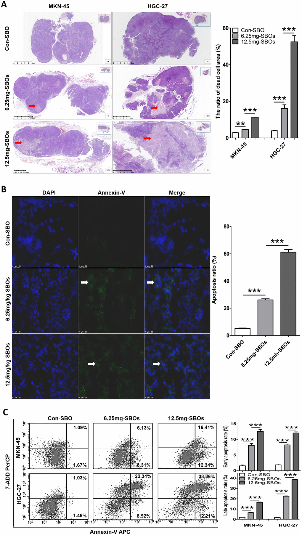 Altered myeloid cell leukemia (Mcl)-1 splicing from Mcl-1L to Mcl-1S promotes apoptosis in vivo. (A) Hematoxylin and eosin staining of tumor sections of the xenograft models is shown. The red arrows indicate dead cells. The dead cell area/overall tumor area increased in a dose-dependent manner after steric-blocking oligonucleotide (SBO) treatment. (B) Immunofluorescence with annexin V staining (the white arrows indicate green fluorescence) showing apoptotic cells in the tumor sections of the HGC-27 xenograft models is presented. The results of the between-group and repeated-measure analyses are shown as the means ± standard deviation (SD). (C) Flow cytometry showing the apoptosis rates of tumor cells treated with SBOs at indicated dosages is presented. Between-group comparison results are shown as the means ± SD.