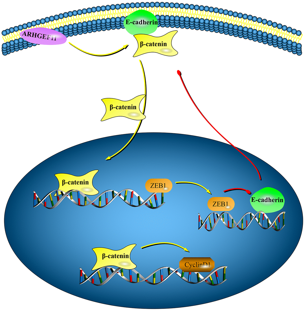 Graphical model displaying the mechanisms of ARHGEF11 in regulating cell cycle and EMT via activating β-catenin. Upregulation of ARHGEF11 promotes β-catenin nuclear translocation from cell membrane. β-catenin activates cyclinD1 transcription, which then leads to cell cycle progression. At the same time, β-catenin enhances ZEB1 transcription, which can inhibit E-cadherin expression, thereby inducing EMT.