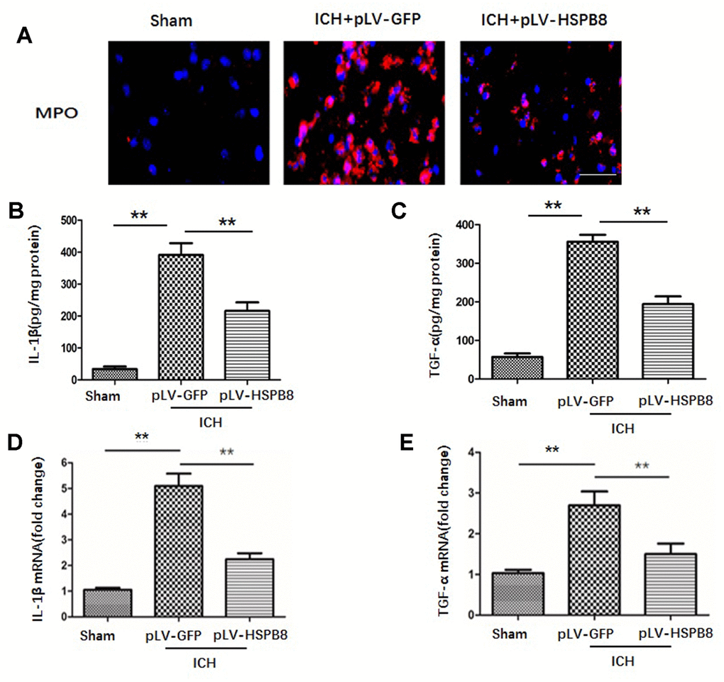 HSPB8 overexpression protected against ICH-induced TJPs degradation. (A) Occludin and claudin-5 expressions were measured by western blot. (B, C) Quantification of occludin and claudin-5 (n=5, mean ± SEM). (D, E) Representative images of occludin and claudin-5 positive vessels. Scale bar=50 μm (n=5, mean± SEM). **P 