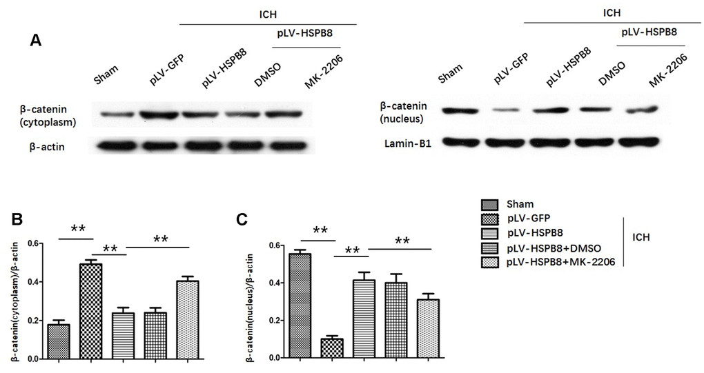 HSPB8 promoted β-catenin nuclear translocation and MK2206 reversed this effect. (A) Representative western blot bands of β-catenin in cytoplasm (left panel) and nucleus (right panel). (B, C) Quantification of plasm-protein HSPB8 and nucleoprotein HSPB8 (n=6, mean± SEM). **P 