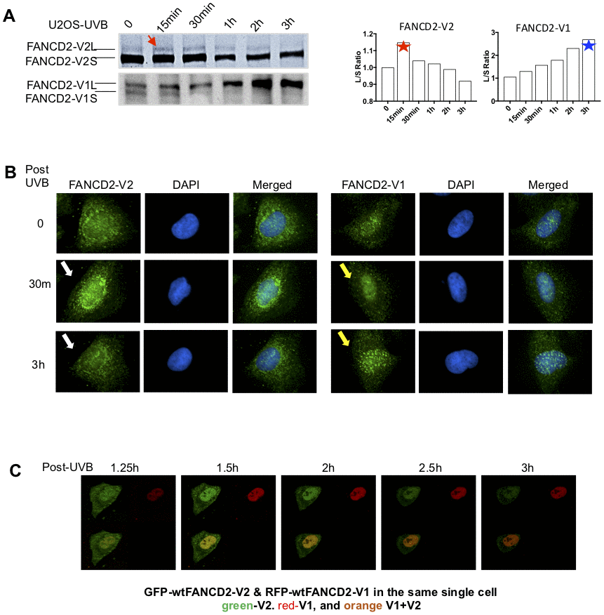 The peak activation of FANCD2-V2 is earlier than FANCD2-V1 in cells treated with UVB. (A) The peak level of monoubiquitinated FANCD2-V2 showed at an earlier time point comparing to FANCD2-V2. U2OS cells were treated with UVB (25J/m2) and collected at the time points indicated in the Figure. Nuclear extractions were subsequently prepared for western blotting of FANCD2-V1 or-V2 proteins through using specific antibodies recognizing V1 or V2 respectively. The relative ratio L/S of monoubiquitinated FANCD2 (L-form) over non-monoubiquitinated FANCD2 (S-form) was shown in the right to indicate different kinetics between the two forms of FANCD2 activation (the ratios of FANCD2-V2 L/S were normalized by the ratio at time 0, considered as 1). (B) Focus formation of FANCD2-V2 is earlier than FANCD2-V1. U2OS cells were treated by UVB (25J/m2) and collected after 30min or 3h, then together with untreated cells were prepared for immunofluorescent studies. Anti-FANCD2-V1 or anti-FANCD2-V1 specific antibodies were used for the primary incubation. The anti-Rabbit-Alexa 488 (green) was used for the secondary incubation. DAPI was used for the nuclear stain. Focus formation of FANCD2-V2 can be shown clearly at 30min after UVB-treatment and vanished at 3h, but FANCD2-V1 foci were not clearly shown until 3h tested. (C) The peak intensity of FANCD2-V2 in the nucleus of a live cell is earlier than FANCD2-V1. The live imaging on cells transfected with both GFP-FANCD2-V2 and RFP-FANCD2-V1 was conducted by taking photos every 30min post UVB-treatment (25J/m2). Owing to the time needed to set up, the earliest image was only available at time 1h 15min post treatment (Supplementary Video 1). The earlier fluorescence peak was further supported by the relative cell fluorescence (Supplementary Figure 1C, the bottom panel), which shows green-fluorescence was dominantly shown in cell nucleus in the early time points in UV-treated cells.