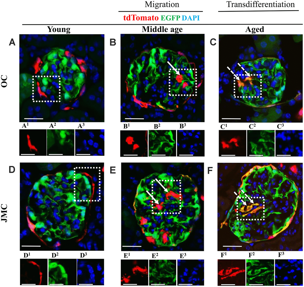 Migration and differentiation of tdTomato+PECs to a podocyte phenotype in aged kidneys. (A–F) Representative confocal images of tdTomato-labeled PECs (red), EGFP+ labeled podocytes (green), and DAPI stained nuclei (blue) in young, middle age and aged mice in OC (A–C) and JMC (D–F). Individual red (labeled with superscript-1), green (superscript-2) and far-red (superscript-3) fluorescent channels of the glomerulus, outlined by the white dashed box. (A) Young mice (OC) showed that tdTomato+PECs are detected along Bowman’s capsule (A1) and EGFP+ cells (A2) localized in typical podocyte distribution. Nuclei were labeled with DAPI (A3). (B) Middle age mice (OC) showed that tdTomato+PECs (marked with solid arrow) were detected in the glomerular tuft (B1) with accompanied decrease in the EGFP signal (B2) and the nuclear marker DAPI (B3). (C) Aged mice (OC) showed that tdTomato+PECs (marked with dashed arrow) (C1) differentiated to a podocyte fate and co-expresses EGFP (green) (C2), overlap creates a yellow. (D) Young mice (JMC) showed that tdTomato+PECs are detected along Bowman’s capsule (D1) and EGFP+ podocytes are observed in the glomerular tuft (D2). (E) Middle age mice (JMC) showed that tdTomato+PECs (marked with solid arrow) are observed in the glomerular tuft (E1) with no overlap with EGFP (E2). (F) Aged mice (JMC) showed that tdTomato+PECs (marked with dashed arrow) (F1) overlap with EGFP (F2) and create a yellow color in the glomerular tuft. Scale bars represent 25μm or 5μm (insets).