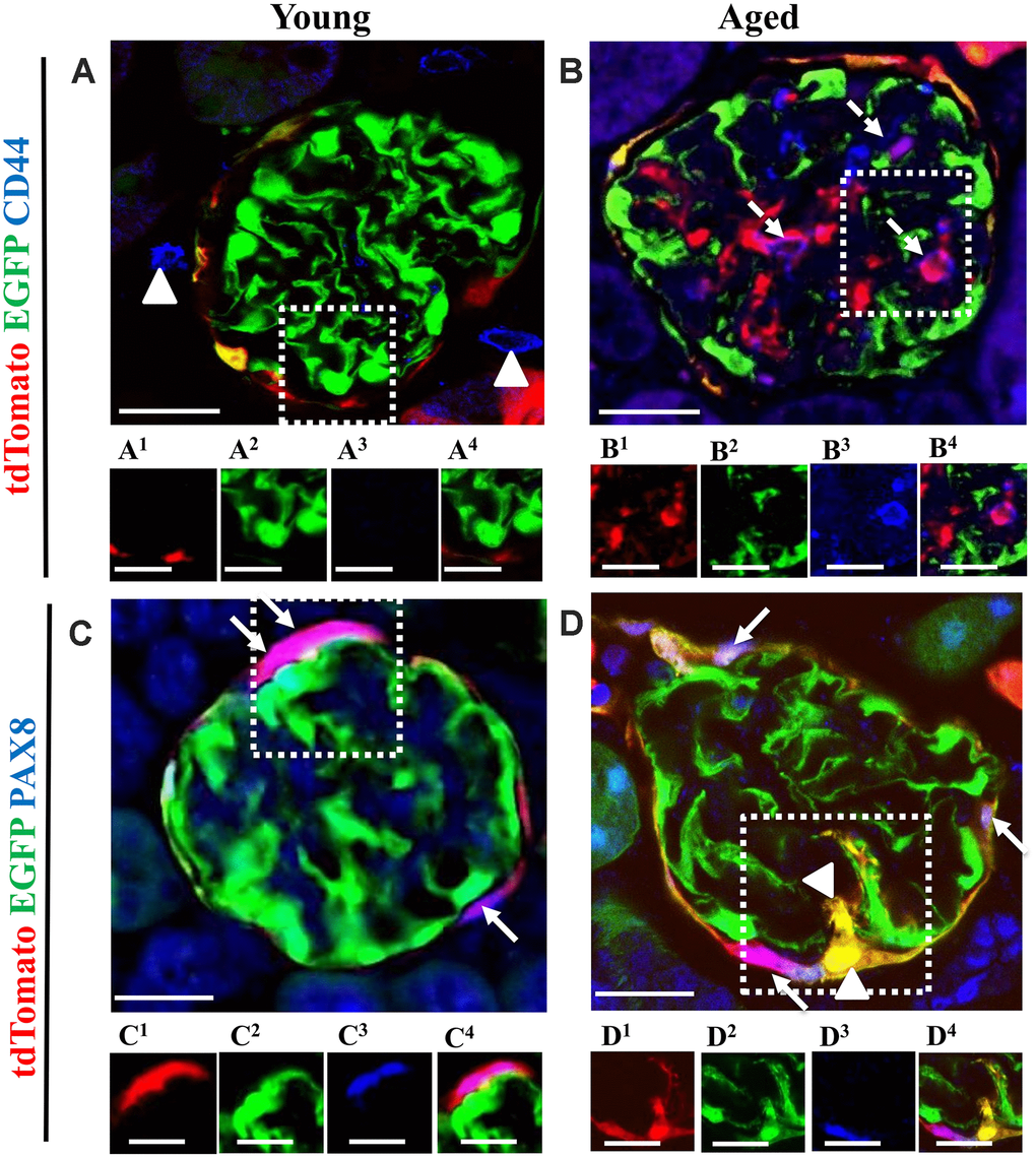 The majority of tdTomato+PECs co-express PAX8 along Bowman’s capsule, however newly generated podocytes from PEC origin no longer express PAX8. Activated PECs (tdTomato+CD44+) were detected in the glomerular tuft of aged mice. (A, B) Representative confocal images of tdTomato+ (red), EGFP+ (green) and CD44+ (blue) in young and aged mice. The inserts show separate channels of the outlined glomeruli, with superscripts: 1=tdTomato, 2=EGFP, 3=CD44 and 4=merged. (A) Young mice showed that CD44 staining was not detected in the glomerular tuft. An occasional CD44+ cell was observed around glomeruli (marked with arrow heads). Each channel for the glomerular tuft region marked with the dashed box are presented in panels (A1–A4). (B) Aged mice showed that a subpopulation of tdTomato+PECs (B1) that migrated to glomerular tuft were positive for CD44 (magenta color, B3- B4), marked with dashed arrows, with no overlap with EGFP (B2). (C, D) Representative confocal images of tdTomato+ (red), EGFP+ (green) and PAX8 (blue) in young and aged mice. The inserts show separate channels of the outlined glomeruli, with superscripts: 1=tdTomato, 2=EGFP, 3=PAX8 and 4=merged. (C) Young mice showed that PAX8 staining (C3) was detected in PECs along Bowman’s capsule and co-localized with tdTomato reporter (C1) creating a pink/purple color (C4) (marked with white arrows). PAX8 was not detected in podocytes (EGFP+ cells) (C2). (D) Aged mice showed that the majority of tdTomato+PECs (D1) co-express PAX8 (D3) creating a magenta/white color (D4) (marked with solid arrow). However, newly generated podocytes from PEC origin (tdTomato+EGFP+) (D1, D2) do not express PAX8 in the glomerular tuft of aged mice (marked with arrow heads). Scale bars represent 25μm or 5μm (insets).