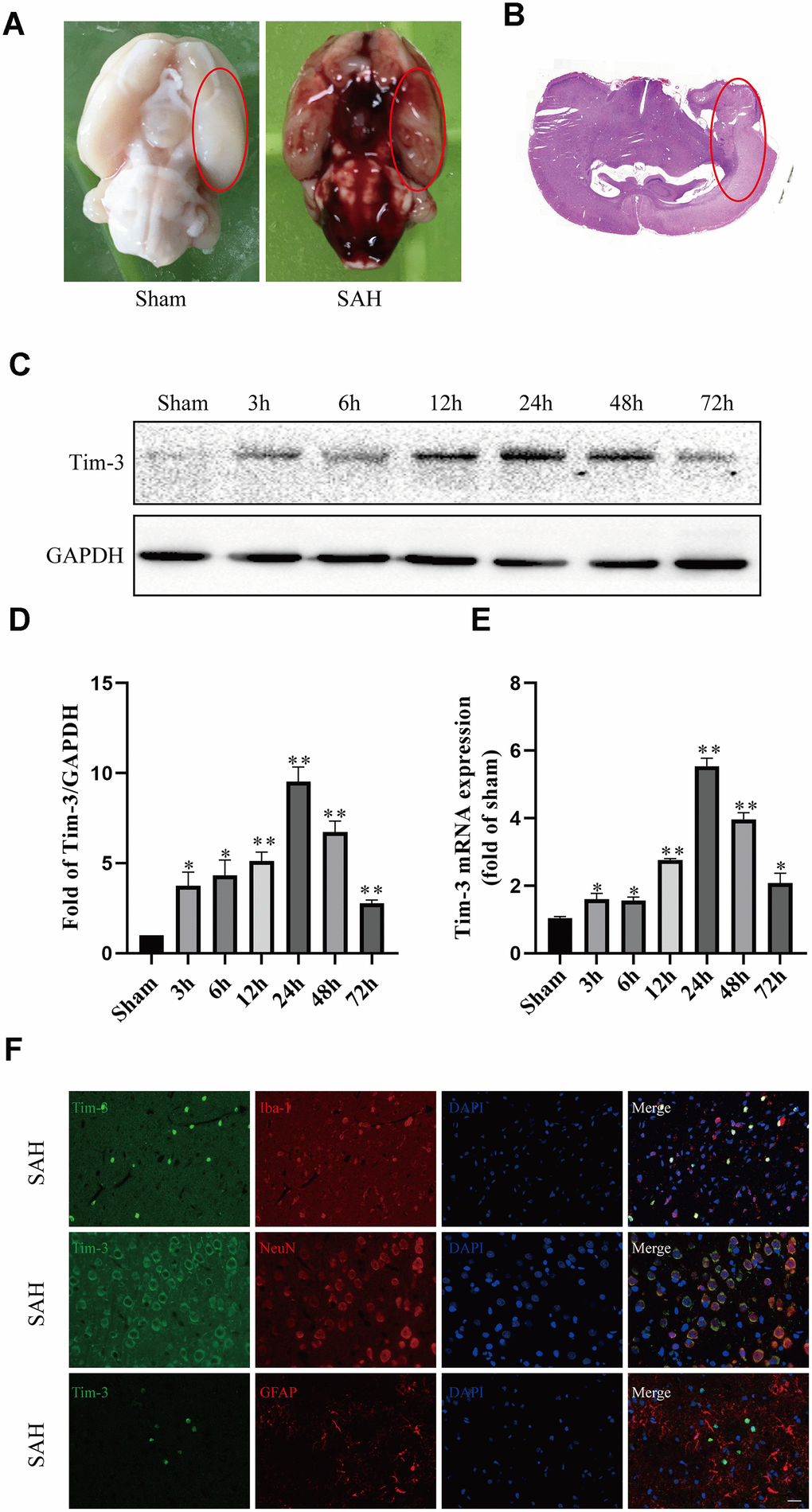 Representative image of the subarachnoid hemorrhage (SAH) model and endogenous expression of Tim-3 in brain tissue. Representative images of brains from the sham and SAH groups. (A) A schematic indicating the optimal brain region for immunochemical staining, qRT-PCR, and western blotting (red circle). (B) Western blot analysis showed Tim-3 protein abundance at 3, 6, 12, 24, 48, and 72 h after SAH. (C) Quantification of the Tim-3 protein level. (D) Quantification of Tim-3 mRNA level in the rat brain. (E) Representative microphotographs of immunofluorescence staining for Tim-3 and Iba1, NeuN, GFAP. (F) All values are presented as means ± SD, n = 6 for each time point per group. *p 