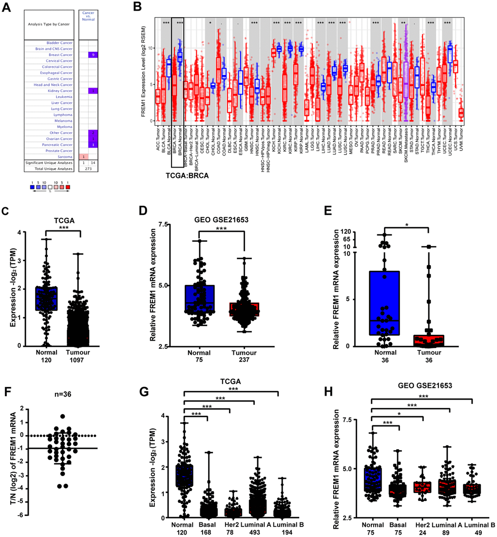 FREM1 expression levels in different types of human cancers. (A) Expression levels of FREM1 in different types of cancer compared with normal tissues. Data is from the Oncomine database. (B) Expression levels of FREM1 in different tumor types from the TCGA database were analyzed by TIMER. (C, D) FREM1 expression levels analyze by TIMER in normal and tumor samples from the TCGA and GEO databases. (E, F) FREM1 expression levels were analyzed by Q-PCR in paired normal and tumor tissues. (G, H) FREM1 expression levels in normal and subtypes of breast cancer samples from the TCGA and GEO databases were analyzed by TIMER. (*P P P 