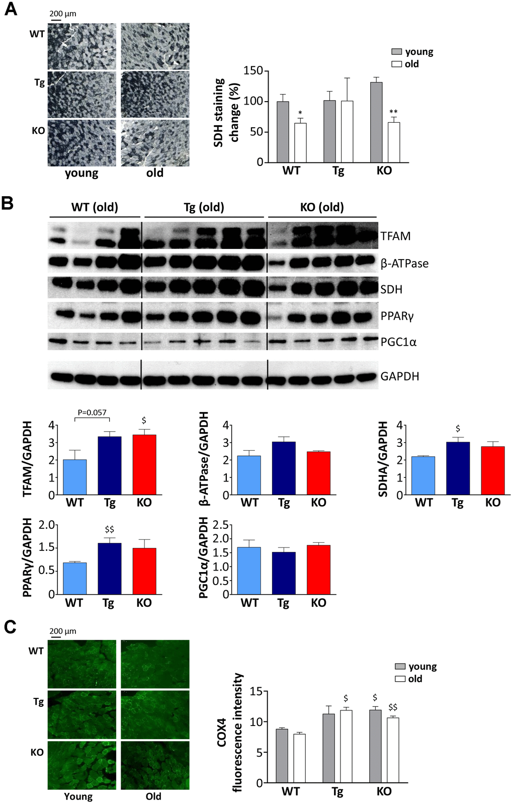 Metabolic shift in TA muscles of WT, Tg, and Ghrl KO mice. (A) Representative images of succinate dehydrogenase (SDH) staining (scale bars: 200 μm) representing the oxidative capacity of TA muscles of 3-month old (young) and 24-month old (old) mice and quantification of SDH-positive fibers in TA muscle presented as the percentage of SDH-positive area above the total muscle surface. Young mice: WT= 5, Tg= 4, Ghrl KO= 5; old mice: WT= 4, Tg= 3, Ghrl KO= 5. (B) Representative Western blots images and protein densitometry quantification for mitochondrial transcription factor A (TFAM), ATP-synthase β-subunit (β-ATPase), succinate-dehydrogenase complex subunit-A (SDHA), peroxisome proliferator-activated receptor gamma (PPARγ), and PPARγ-coactivator-1-α (PGC1α) protein levels. Protein levels were probed in gastrocnemii of old mice, WT= 4, Tg= 5, Ghrl KO= 5. (C) Representative images of cytochrome c oxidase subunit 4 (COX4) immunofluorescence (scale bars: 200 μm) and quantification. Young mice: WT = 3, Tg = 3, Ghrl KO = 3; old mice: WT = 4, Tg = 4, Ghrl KO = 4. Data are presented as mean ± SEM. *p$p$$pGhrl KO vs. WT.