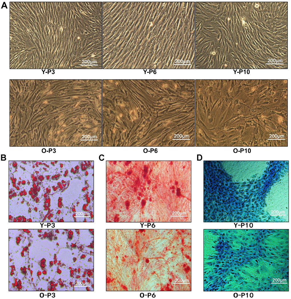 Characterization of ADSCs. (A) 3rd, 6th, and 10th passage Spindle-shaped ADSCs in young and old donors. Y-P3, Y-P6, Y-P10 represent the 3rd, 6th, and 10th passages of the young donor, respectively. O-P3, O-P6, O-P10 represent the 3rd, 6th, and 10th passages of the old donor, respectively. (B) Micrographs of 3rd generation ADSCs of young patients (up) and old patients (down) stained with Oil Red O. (C) Micrographs of 3rd generation ADSCs of young patients (up) and old patients (down) stained with Alizarin Red. (D) Micrographs of 3rd generation ADSCs of young patients (up) and old patients (down) stained with Alcian Blue.