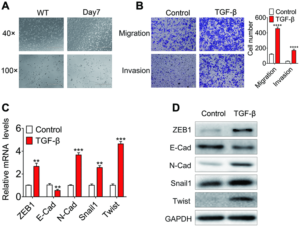 Identification of the EMT cell model based on TGF-β treatment. (A) Phase-contrast micrographs of Huh7 cells treated with 10 ng/ml TGF-β for 7 days or left untreated. Scale bar = 100 μm; (B) In vitro migration and invasion of Huh7 cells treated with 10 ng/ml TGF-β or left untreated. The number of migrated cells per field was counted after 48 h. (C) Relative mRNA levels of E-cadherin, ZEB1, SNAIL1, Twist and N-cadherin in Huh7 cells treated with 10 ng/ml TGF-β for 7 days or left untreated. (D) Relative protein levels of E-cadherin, ZEB1, SNAIL1, Twist and N-cadherin in Huh7 cells treated with 10 ng/ml TGF-β for 7 days or left untreated.