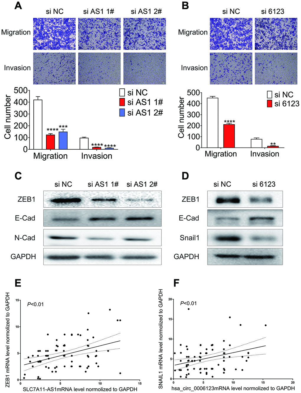 Knockdown of lncRNA SLC7A11-AS1 and hsa