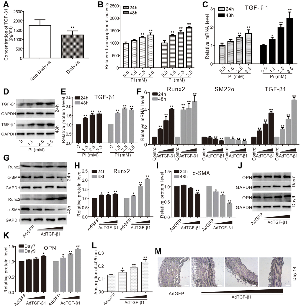 Effects of TGF-β1 on calcification in VSMCs and aortic segments. (A) ELISA assay results show the serum levels of TGF-β1 in patients with CKD experienced with dialysis or non-dialysis (n=40) ("**" pB) Reporter assay results show the effect of high phosphate on TGF-β signaling ("**" pC) Real-time PCR assay results show the impact of high phosphate on mRNA expression of TGF-β1 ("*" pD) Western blot assay results show the effect of high phosphate on TGF-β1; GAPDH was used as a loading control. (E) Quantification results of Western blot assay show the effect of high phosphate on TGF-β1 ("**" pF) Real-time PCR assay results show the effect of TGF-β1 recombinant adenovirus on mRNA expression of Runx2, SM22α, and TGF-β1 ("*" pG) Western blot assay results show the effect of TGF-β1 on Runx2 and α-SMA in VSMCs; GAPDH was used as a loading control. (H) Quantification results of Western blot assay show the effect of TGF-β1 on Runx2 in VSMCs("*" pI) Quantification results of Western blot assay show the effect of TGF-β1 on α-SMA in VSMCs ("*" pJ) Western blot assay results show the effect of TGF-β1 on OPN in VSMCs; GAPDH was used as a loading control. (K) Quantification results of Western blot assay show the effect of TGF-β1 on OPN in VSMCs ("*" pL) Quantitative analysis results of Alizarin Red S staining show the effect of exogenous TGF-β1 on inducing mineralization in VSMCs ("*" pM) The Von Kossa staining results show the effect of TGF-β1 on calcification in thoracic segments (Scale=100 μM), Pi: phosphate.