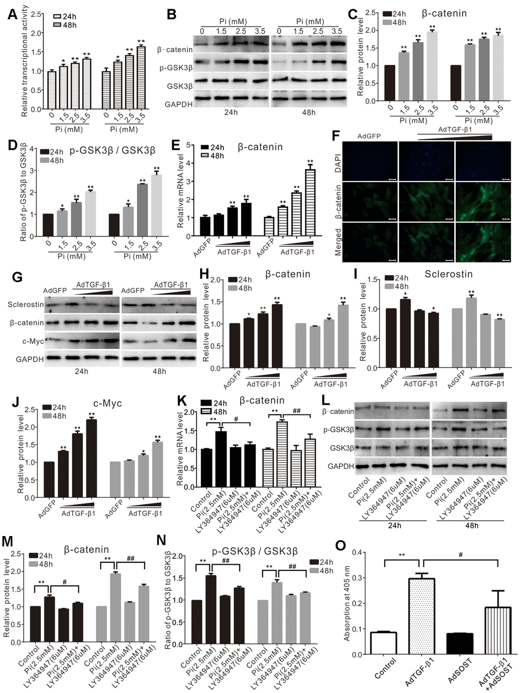 Effects of high phosphate and/or TGF-β1 on Wnt/β-catenin in VSMCs. (A) Luciferase reporter assay results show the effect of high phosphate on Wnt/β-catenin signal ("*" pB) Western blot assay results show the effect of high phosphate on β-catenin, p-GSK-3β, and GSK-3β in VSMCs cells; GAPDH was used as a loading control. (C) Quantification results of Western blot assay show the effect of high phosphate on β-catenin in VSMCs cells ("**" pD) Quantification results of Western blot assay show the effect of high phosphate on p-GSK-3β and GSK-3β in VSMCs cells ("*" pE) Real-time PCR assay results show the effect of TGF-β1 on mRNA expression of β-catenin in VSMCs cells ("**" pF) Immunofluorescent staining results show the effect of TGF-β1 on β-catenin and its localization in VSMCs (Scale=50 μM). (G) Western blot assay results show the effect of TGF-β1 on sclerostin, β-catenin, and c-Myc in VSMCs cells, GAPDH was used as a loading control. (H) Quantitative results of Western blot assay show the effect of TGF-β1 on β-catenin in VSMCs cells ("*" pI) Quantitative results of Western blot assay show the effect of TGF-β1 on sclerostin in VSMCs cells ("*" pJ) Quantitative results of Western blot assay show the effect of TGF-β1 on c-Myc in VSMCs cells ("*" pK) Real-time PCR assay results show the effect of high phosphate and/or LY364947 on mRNA expression of β-catenin in VSMCs cells ("**" pL) Western blot assay results show the effect of high phosphate and/or LY364947 on β-catenin, p-GSK-3β, and GSK-3β in VSMCs cells; GAPDH was used as a loading control. (M) Quantitative results of Western blot assay show the effect of high phosphate and/or LY364947 on β-catenin in VSMCs cells ("**" pN) Quantitative results of Western blot assay show the effect of high phosphate and/or LY364947 on p-GSK-3β and GSK-3β in VSMCs cells ("**" pO) Quantitative analysis results of Alizarin Red S staining show the effect of TGF-β1 and/or sclerostin on mineralization in VSMCs ("**" p