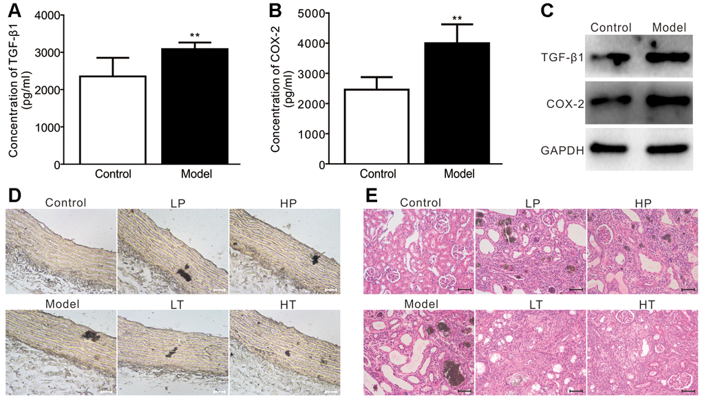 Effects of meloxicam on adenine-induced renal failure in rats. (A) ELISA analysis results show the serum level of TGF-β1 in adenine-induced rat renal failure (n=10, "**" pB) ELISA analysis results show the serum level of COX-2 in adenine-induced rat renal failure (n=10, "**" pC) Western blot assay results show the protein level of TGF-β1 and COX-2 in the aorta from a rat; GAPDH was used as a loading control. (D) Von Kossa staining results show the calcification in aorta from adenine-induced rat renal failure, which were treated with preventive or therapeutic administration of meloxicam (Scale=100 μM). (E) H&E staining results show the pathological changes in adenine-induced rat renal failure, which were treated with preventive or therapeutic administration of meloxicam (Scale=50 μM). LP: low-dose prevention, HP: high-dose prevention, LT: little dose therapy, HT: high-dose therapy.