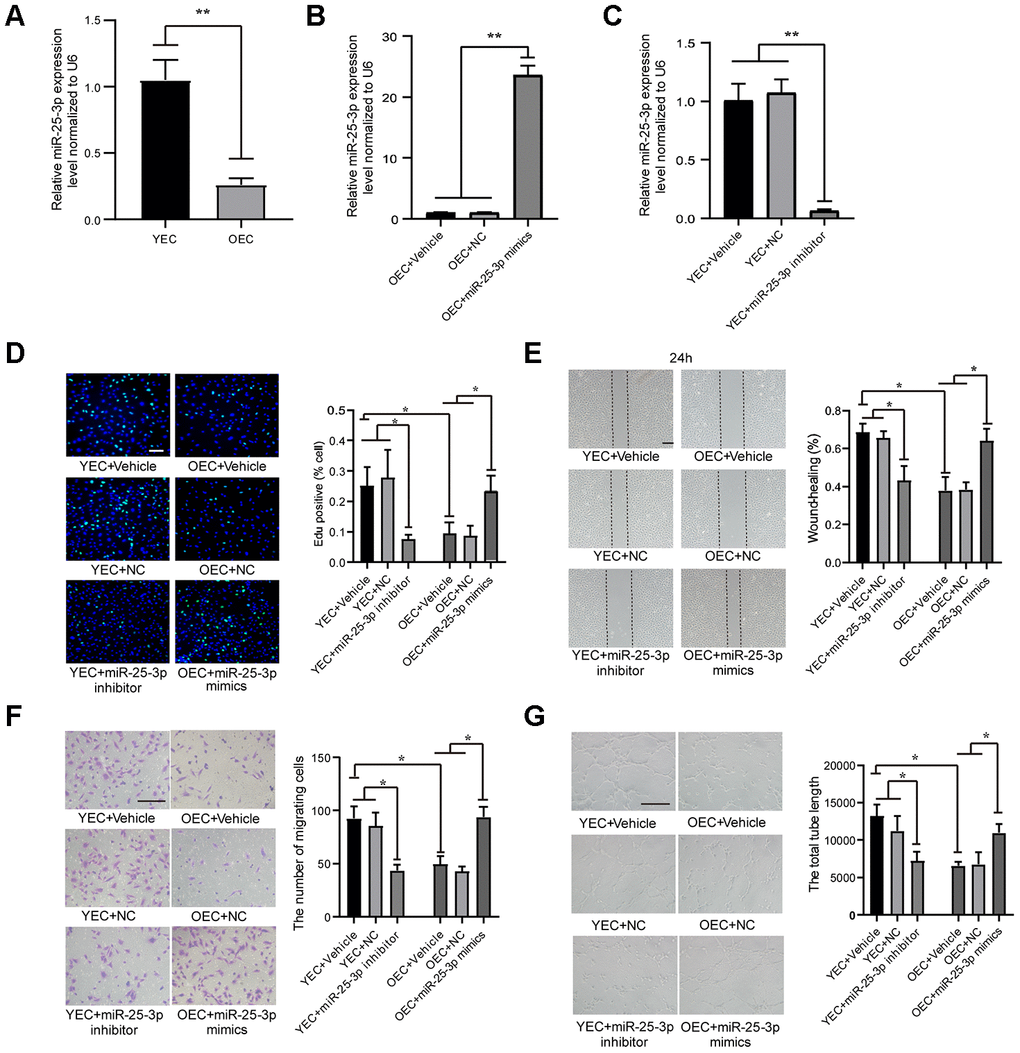 MiR-25-3p expression in ECs: transfection with an miR-25-3p mimic or inhibitor regulates angiogenesis in vitro. (A) RT-qPCR analysis showed that the expression of miR-25-3p was downregulated in old endothelial cells (OECs) versus young endothelial cells (YECs) (n=3). (B) RT-qPCR analysis showed that the expression of miR-25-3p was upregulated in OECs with miR-25-3p mimics(n=3). (C) RT-qPCR analysis showed that the expression of miR-25-3p was downregulated in YECs with miR-25-3p inhibitor(n=3). (D) An EdU assay showed that mouse EC proliferation was increased by the transfection of miR-25-3p mimics into OECs, whereas the miR-25-3p inhibitor showed the opposite effect in YECs (n=5; Scale bar, 100 μm). (E) A wound-healing assay showed that miR-25-3p mimics promoted the migration ability of OECs, whereas the miR-25-3p inhibitor showed the opposite effect in YECs (n=4; scale bar, 200 μm). (F) Transwell assays showed that miR-25-3p mimics promoted the migration ability of OECs, whereas the miR-25-3p inhibitor showed the opposite effect in YECs (n=5; scale bar, 100 μm). (G) Tube formation determined on Matrigel showed that miR-25-3p mimics increased the total tube length of OECs, whereas the miR-25-3p inhibitor showed the opposite effect in YECs (n=4; Scale bar, 100 μm) (*P 