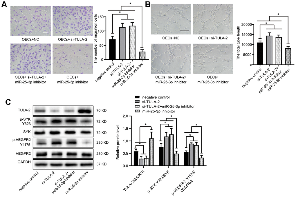 TULA-2 knockdown positively regulates angiogenesis in vitro and increases p-SYK Y323 and p-VEGFR-2 Y1175 expression at the protein level. (A) Transwell assays showed that TULA-2 siRNA promoted the migration ability of OECs, and co-transfection of OECs with both si-TULA-2 and miR-25-3p inhibitors did not suppress the effect of TULA-2 upregulation on EC migration relative to the effects of siRNA-NC (n=5; Scale bar, 100 μm). (B) Tube formation determined on Matrigel showed that TULA-2 siRNA increased the total tube length, and co-transfection of OECs with both si-TULA-2 and miR-25-3p inhibitors did not suppress the effect of TULA-2 upregulation on EC tube formation relative to the effects of siRNA-NC (n=4; scale bar, 100 μm). (C) Western blot analysis of relative TULA-2, SYK Y323 and VEGFR-2 Y1175 expression in OECs transfected with the negative control, si-TULA-2, si-TULA-2+ miR-25-3p inhibitor and miR-25-3p inhibitor (data are expressed as the mean ± SEM, *P 