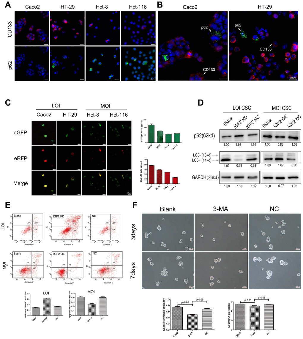 The affection of IGF2 LOI in CSCs autophagy. (A) the IF results of CD133 and p62 in IGF2 LOI cells (Caco2 and HT-29) and MOI cells (Hct-8 and Hct-116); (B) the IF results of p62 in Caco2 or HT-29 CD133+cells and CD133- cells. CD133+ cells showed a lower p62 expression than CD133- cells; (C) the green-puncta and red-puncta numbers of CSCs cells in mRFP-eGFP-LC3fluorescence assay. After hunger for 6 hours, IGF2 LOI CSCs showed higher numbers of green and red LC3 dots per cell than IGF2 MOI cells(pD) the p62 and LC3-II expression in IGF2 LOI and MOI CSCs with different treatment; (E) the apoptosis rates of IGF2 LOI and MOI CSCs with different treatment; (F) the sphere formation efficiency and IGF2 mRNA expression of IGF2 LOI CSCs treated with 3-MA.