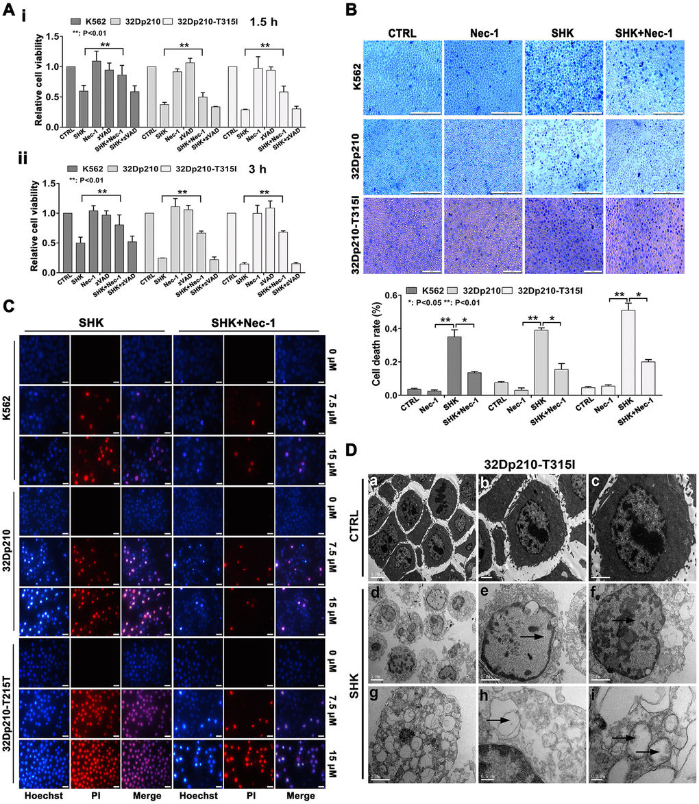 Shikonin induces necroptosis in CML cells. (A) Results of MTT proliferation assays in K562, 32Dp210, and 32Dp210-T315I CML cells treated with 10 μΜ shikonin for 1.5 h (i) or 3 h (ii) following pre-treatment (1 h) with Nec-1 (50 μΜ) or zVAD-fmk (35 μΜ). Data are presented as the mean ± SD of three independent experiments. (B) Trypan blue exclusion assay results. CML cells were pretreated with or without 50 μΜ Nec-1 for 1 h and subsequently exposed to 10 μΜ shikonin for 3 h. The cells were then stained with trypan blue and the percentage of dead cells was determined under light microscopy. (C) Hoechst 33342/PI double staining was performed in CML cells preincubated with or without 50 μΜ Nec-1 and then treated with 0, 7.5, or 15 μΜ shikonin for 3 h. The percentage of PI-permeable cells in each group was determined by fluorescence microscopy. Blue fluorescence indicates staining with Hoechst 33342 and red fluorescence indicates PI staining. A few cells exhibited apoptotic characteristics (chromatin condensation and nuclear fragmentation), as indicated by white arrowheads. Magnification, 200×. (D) Electron microscopic examination of 32Dp210-T315I cells treated with 20 μM shikonin for 3 h revealed typical necrotic changes, including disorganization and loss (empty bubble-like formations) of cytoplasmic structures and plasma membrane rupture (d, g, h); syncytial nuclei with chromatin dissolution and disappearance of nucleoli (e, f); and severe damage to mitochondria with disruption of internal structures (i). Scale bars: 5 μm (a, d), 2 μm (b, c, e, f, g), 0.5 μm (h), and 0.2 μm (i). Quantification data are presented as the mean ± SD of three independent experiments. Representative results from three samples are shown. *p 