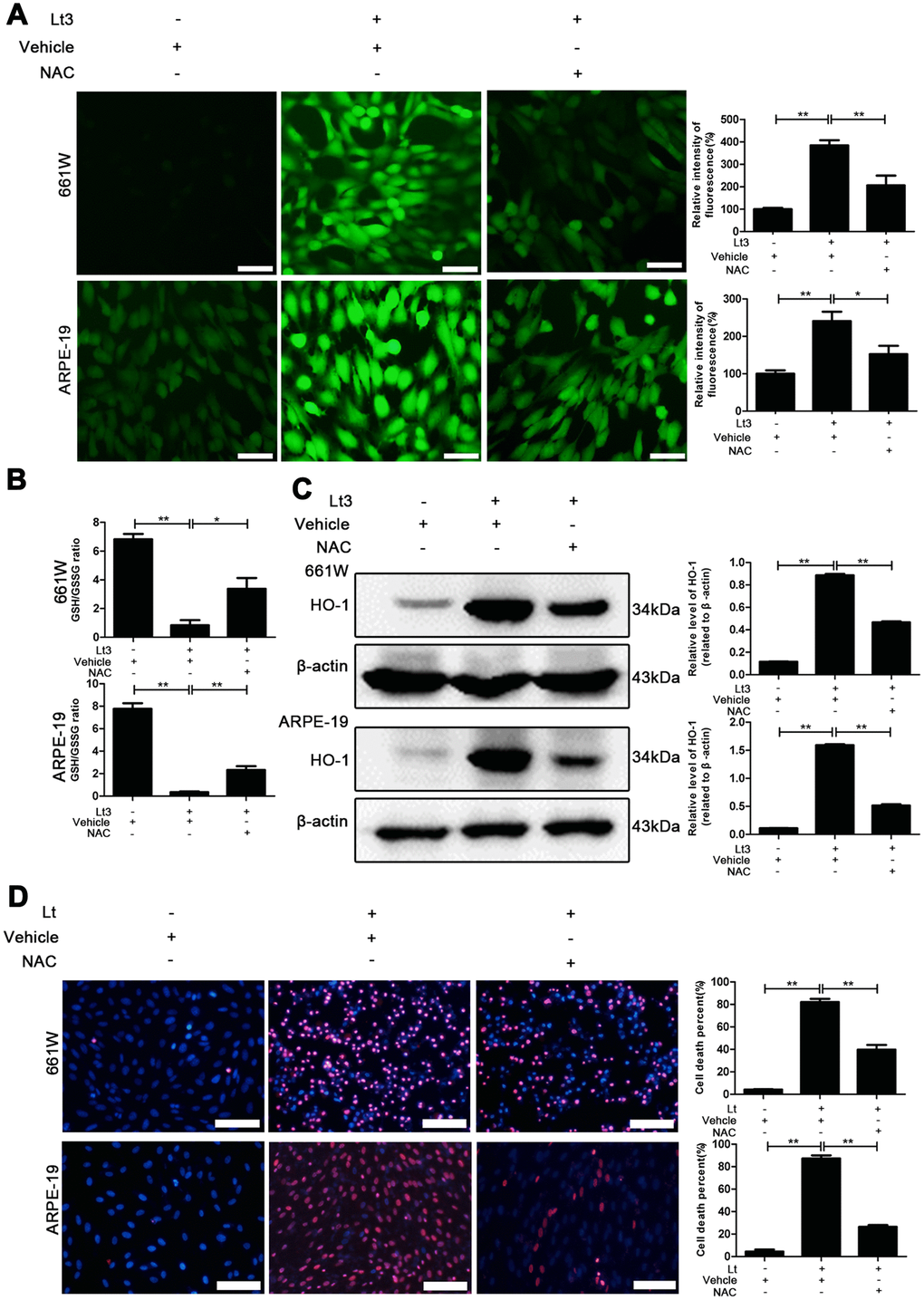 NAC treatment suppresses light-induced oxidative stress. 661W cells/ARPE-19 cells were pretreated with NAC (5 mM for 661W cells and 2.5 mM for ARPE-19 cells) or vehicle and cultured under light/dark conditions for 3 days. (A) The intracellular ROS were stained with DCFH-DA fluorescent probe identified by green fluorescence. Scale bar=50 μm. Relative fluorescence intensities were calculated and compared. (B) The GSH/GSSG ratio was measured with a GSH/GSSG Assay Kit. (C) The HO-1 level was determined with western blotting, and β-actin was referred as an internal control. (D) 661W cells pretreated with 5 mM NAC/vehicle were cultured under light/dark conditions for 3 days. ARPE-19 cells pretreated with 2.5 mM NAC/vehicle were cultured under light/dark conditions for 6 days. The cell death percentage was evaluated with PI/Hoechst staining. Scale bar=100μm. The percentage of cell death was calculated as PI-positive cells/total cells%. Three independent experiments are conducted two weeks apart. The results are presented as the mean± SEM. n (per group) =3, *P 