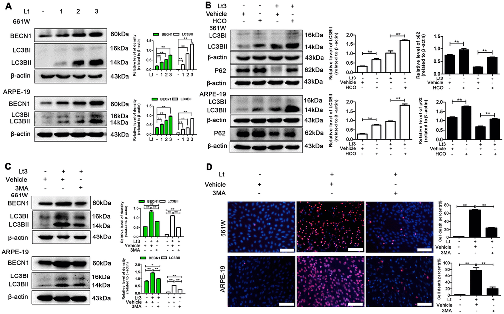 Inhibiting light-induced prolonged autophagy is protective. (A) 661W cells/ARPE-19 cells were cultured in a dark condition or exposed to 1500 Lux light for 1–3 days. The levels of BECN1 and LC3BII in the whole cell lysate was determined with western blotting, and β-actin was referenced as an internal control. (B) After 661W cells and ARPE-19 cells were treated with HCO (20 μM) or vehicle and cultured under light/dark conditions for 3 days, the level of LC3BII and P62 in the whole cell lysate were determined with western blotting, and β-actin was referenced as an internal control. (C) The cells were treated with 3MA (2.5 mM for 661W cells; 1 mM for ARPE-19) or vehicle and cultured under light/dark conditions for 3 days. The level of BECN1 and LC3BII in the whole cell lysate were determined with western blotting, and β-actin was referenced as an internal control. (D) 661W cells pretreated with 2.5 mM 3MA/vehicle were cultured under light/dark conditions for 3 days. ARPE-19 cells pretreated with 1 mM 3MA/vehicle were cultured under light/dark conditions for 6 days. The percentage of cell death was evaluated with PI/Hoechst staining. Scale bar=100 μm. Three independent experiments are conducted two weeks apart. The results are presented as the mean± SEM. n (per group) =3, *P 