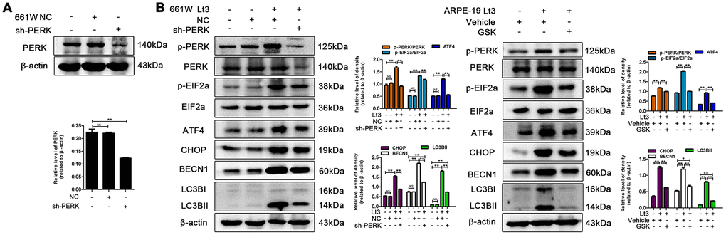 Inhibiting PERK suppresses light-related autophagy. (A) 661W cells were infected with lentivirus-expressed PERK shRNA (sh-PERK) or negative control shRNA (NC). The level of PERK in the whole cell lysate was determined with western blotting, and β-actin was referenced as an internal control. (B) 661W cells with stable PERK knockdown/ARPE-19 cells treated with GSK (5 μM) or vehicle were cultured under light/dark conditions for 3 days. The target proteins in the whole cell lysate were determined with western blotting, and β-actin was referenced as an internal control. Three independent experiments are conducted two weeks apart. The results are presented as the mean± SEM. n (per group) =3, NS: no significance, *P 