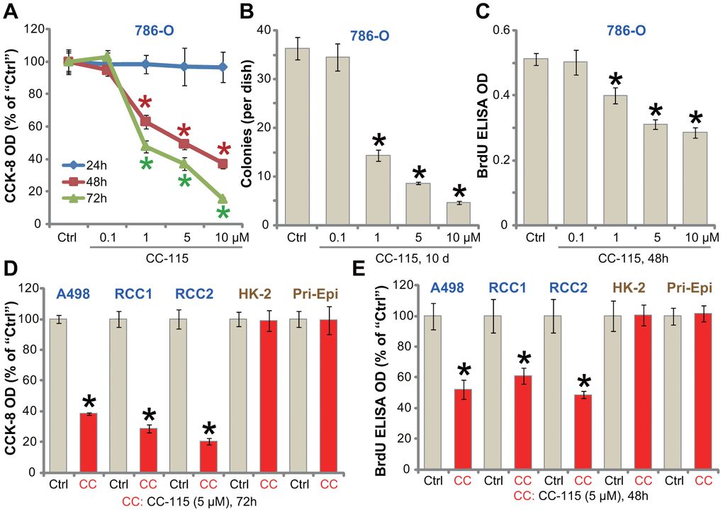 CC-115 inhibits human RCC cell survival and proliferation. Established human RCC cell lines (786-O and A498), the primary human RCC cells (derived from two patients, “RCC1/2”), immortalized HK-2 tubular epithelial cells as well as the primary human renal epithelial cells (“Pri-Epi”) were treated with indicated concentration of CC-115 for the applied time periods, cell viability was tested by CCK-8 assay (A, D); Cell proliferation was tested by soft agar colony formation assay (B) and the BrdU ELISA assay (C, E). Data were expressed as mean ± standard deviation (SD, same for all Figures). * P 