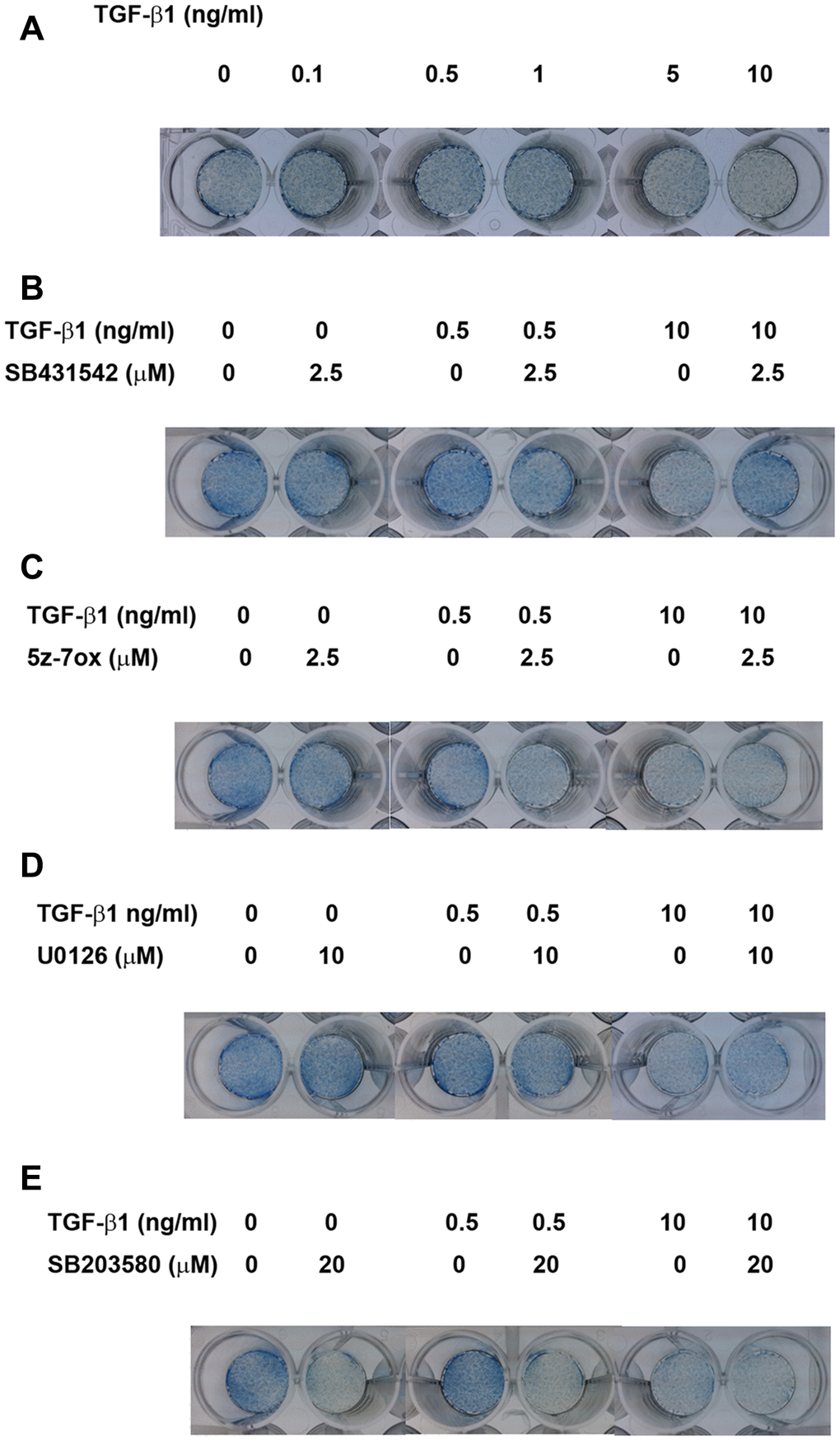 Effect of TGF-β1 on the ALP activities of cultured SHED as analyzed by ALP staining. (A) ALP staining of SHED after exposure to TGF-β1 for 5 days. (B) Effect of SB431542 on the TGF-β1-induced increase or decrease in ALP activity of SHED. (C) Effect of 5z-7oxozeaenol on the TGF-β1-induced increase or decrease in ALP activity of SHED. (D) Effect of U0126 on the TGF-β1-induced increase or decrease in ALP activity of SHED. (E) Effect of SB203580 on the TGF-β1-induced increase or decrease in ALP activity of SHED. One representative ALP staining result was shown.