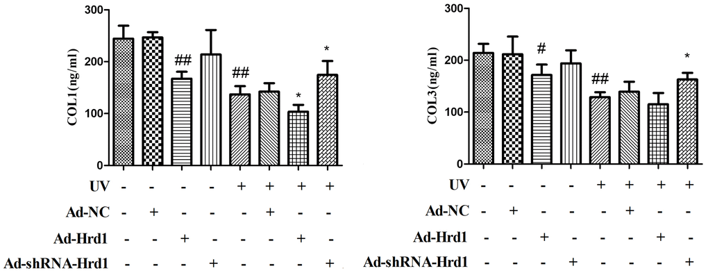 The effect of Hrd1 transfection on UV-Induced collagens degradation in HSF cells by ELISA method. The results were presented as mean ± SD. ##