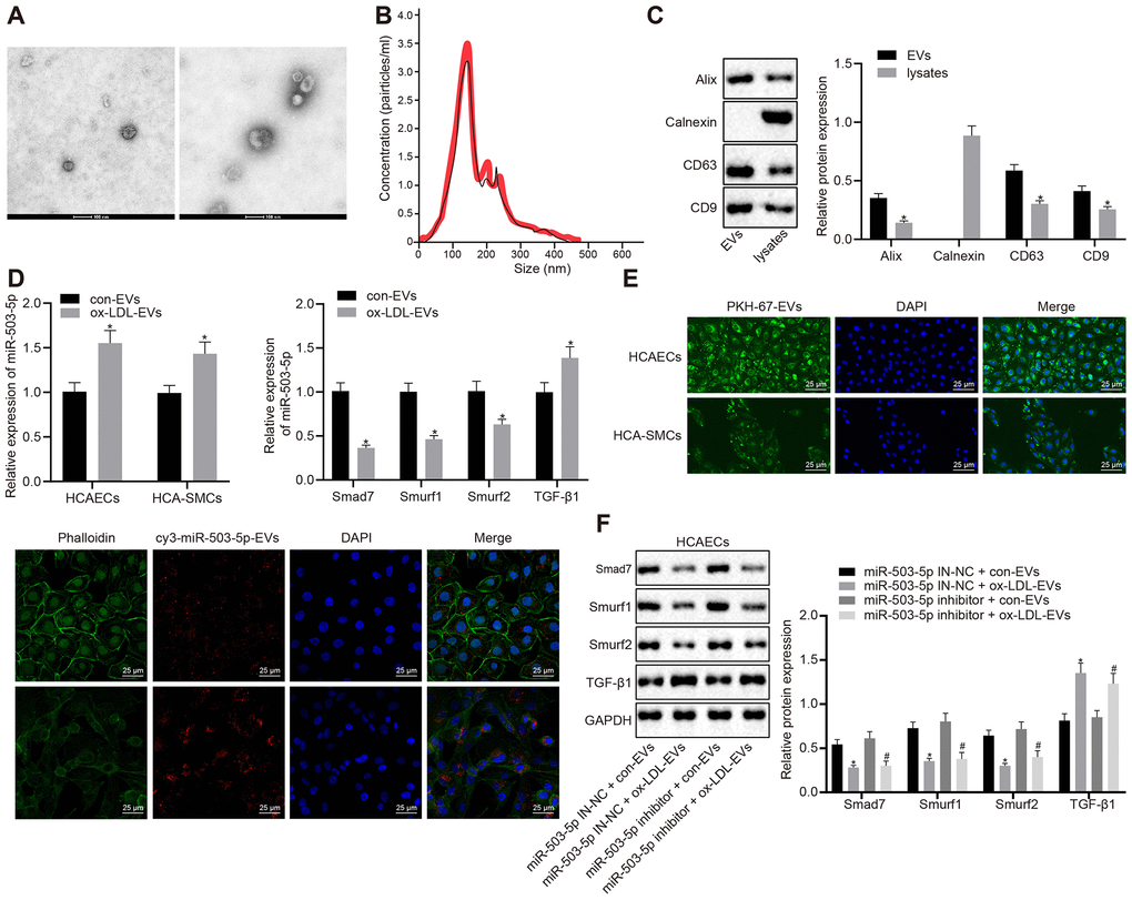 Delivery of miR-503-5p to HCAECs and HCASMCs by macrophage-derived EVs. (A) Structure and diameter of EVs observed by TEM (×100000). (B) Diameter and number of EVs measured by NTA. (C) Expression of EV marker proteins Alix, CD63, and CD9 determined by Western blot analysis; *p D) Expression of miR-503-5p (normalized to U6), TGF-β1, smad7, smurf1, and smurf2 (all normalized to GAPDH) in HCAECs and HCASMCs determined RT-qPCR; *p E) EVs were phagocytosed by HCAECs and HCASMCs, observed under laser confocal microscope. PKH67-labeled EVs was green, DAPI-stained nuclei was blue, while cy3-miR-503-5p-labeled EVs was red (×400). (F) Protein expression of TGF-β1, smad7, smurf1, and smurf2 (normalized to GAPDH) in HCAECs determined by Western blot analysis. Values obtained from three independent experiments in triplicate were analyzed by unpaired t test between two groups and by one-way ANOVA followed by Tukey's post hoc test among three or more groups. *p 