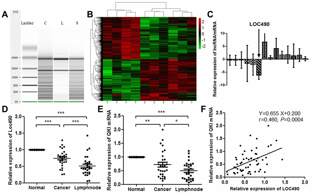 Low expression of Loc490 in GC and lymph node metastasis tissue. (A) RNA quality testing (C: GC tissue; L: lymph node metastasis tissue; N: normal tissue adjacent to GC); (B) Screening for differentially expressed lncRNAs using Agilent Human LncRNA chip technology in normal tissues adjacent to GC, primary GC tissues and lymph node metastasis tissues; (C) Loc490 expression was significantly lower in lymph node metastases than in normal tissues adjacent to GC and in primary GC tissue (the other selected genes are shown in the article); (D) qRT-PCR results demonstrating Loc490 expression in 28 normal tissues adjacent to GC, primary GC tissues and lymph node metastasis tissues; (E) Expression of QKI mRNA in 28 normal tissues adjacent to GC, primary GC tissues and lymph node metastases; (F) Correlation analysis demonstrating that Loc490 expression was significantly positively correlated with QKI mRNA expression. Data represent the mean and SD from three experiments. **p 