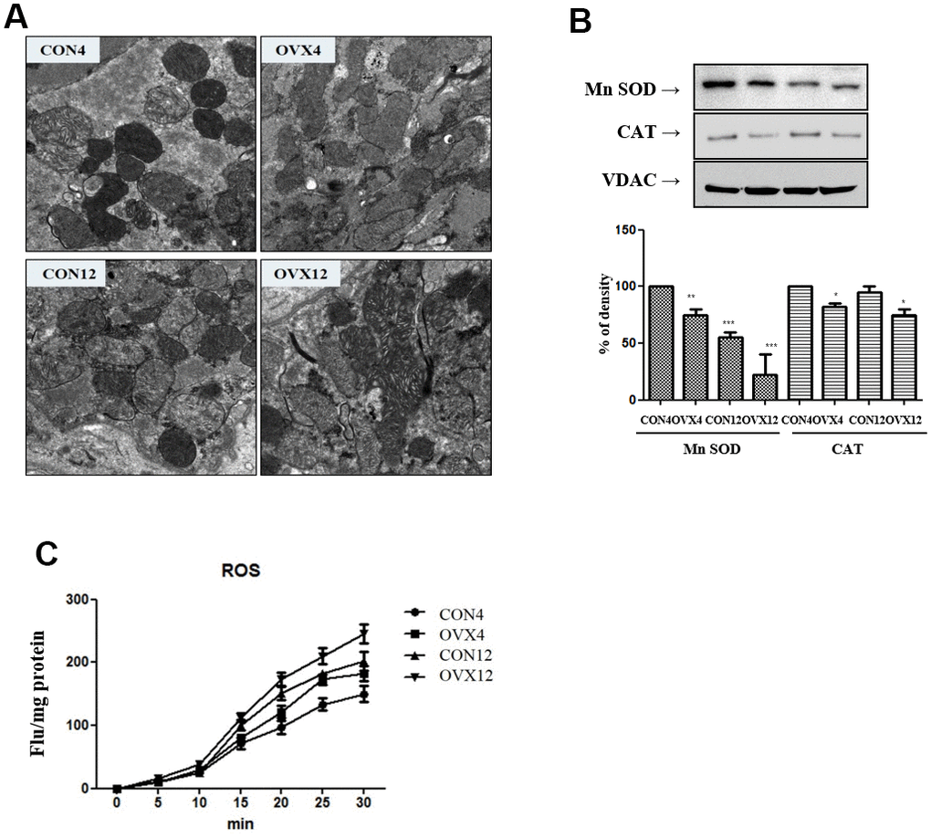 Mitochondria dysfunction. (A) Electron microscopy of submandibular gland in the CON and OVX groups. (B) Western blotting of antioxidant enzyme; SOD and catalase and control VDAC in the CON and OVX groups. (C) ROS generation in the CON and OVX groups. CON = control, OVX = ovariectomy, SOD = superoxide dismutase, CAT = catalase, VDAC = voltage-dependent anion channel.