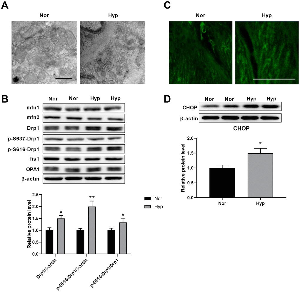 Hypoxia induced mitochondrial fragmentation and ER stress in PASMCs. (A) Ultrastructural alteration of the mitochondria and ER in pulmonary artery smooth muscle of normoxic and hypoxic rats. Scale bar, 500 nm. (B) Expression of mitochondrial dynamics-related proteins in endothelium-denuded pulmonary arteries. Twenty micrograms of protein was loaded in each lane. (C) Mitochondrial ROS detected by mitoSOX in isolated pulmonary arteries. Scale bar, 20 μm. (D) ER stress as assessed by CHOP expression in endothelium-denuded pulmonary arteries. Twenty micrograms of protein was loaded for each lane. *, pp