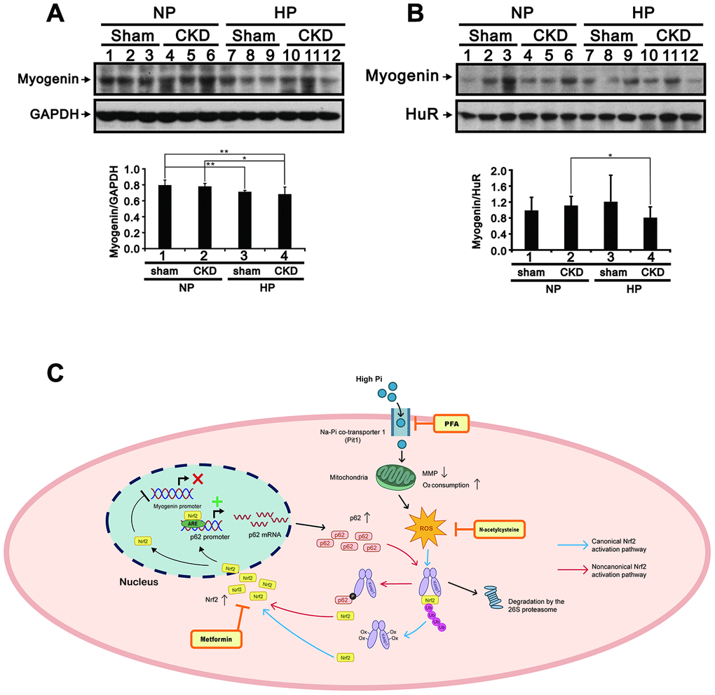 High-Pi diet alters myogenin expression in GA muscle from sham-operated and CKD mice. Representative myogenin immunoblots from cytosolic (A) and nuclear (B) GA muscle fractions. Levels of these proteins were quantified by computer-assisted densitometric analysis. Data are presented as means ± SEM. *P C) Schematic illustration of the molecular mechanism by which high Pi represses myogenic differentiation and promotes muscle atrophy. GA, gastrocnemius muscle; PFA, phosphonoformic acid; MMP, mitochondrial membrane potential; ROS, reactive oxygen species; ub-Nrf2, ubiquitinated Nrf2; ARE, antioxidant response element; Ox-Keap1, oxidized Keap1; p-p62, phosphorylated p62.