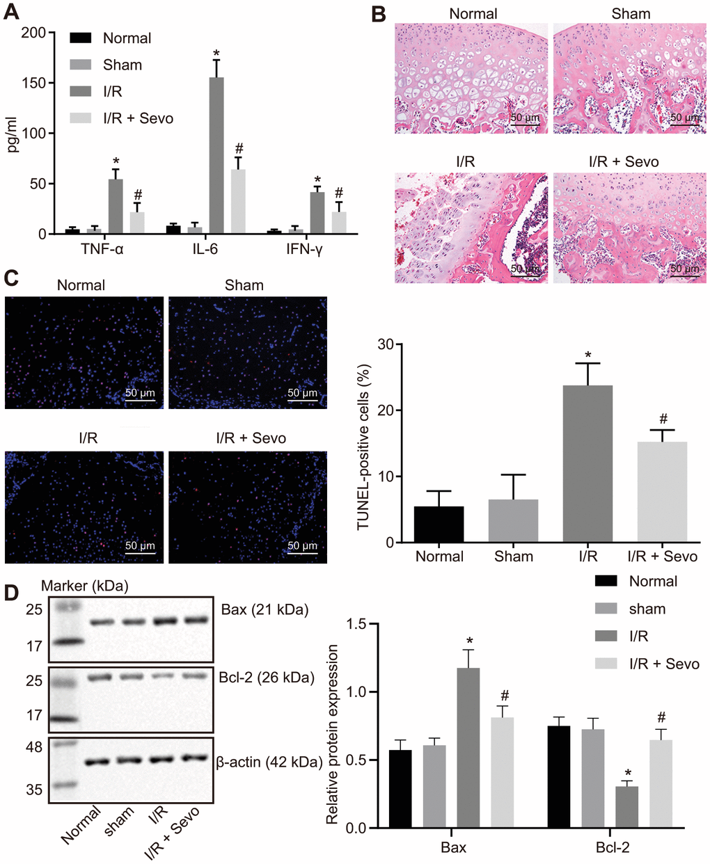 I/R injury is inhibited by Sevoflurane treatment in mice following TKA. (A) Levels of IFN-γ, IL-6 and TNF-α in serum of mice measured by ELISA. (B) HE staining of knee joint tissues of mice (× 200). (C) Cell apoptosis in knee joint tissues of mice measured by TUNEL assay (× 200). (D) Protein expression patterns of proliferation- and apoptosis-markers examined by Western blot analysis. * p p 