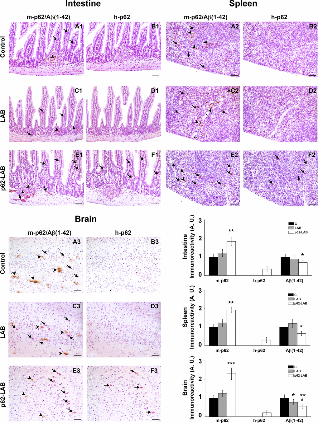 IHC analysis of intestine, spleen and brain from control, LAB and p62-LAB treated mice. Tissue sections from duodenal mucosa, spleen and brain, specifically the hippocampal region, were stained with an anti-rodent p62 antibody (purple), an anti-human p62 antibody (purple) and an anti-Aβ(1-42) antibody (brown). Panels A1-B1, C1-D1, and E1-F1 show consecutive intestinal sections, panels A2-B2, C2-D2, and E2-F2 show consecutive spleen sections and panels A3-B3, C3-D3, and E3-F3 show consecutive brain sections. Immunohistochemical double-staining for m-p62 (arrows) and Aβ(1-42) (arrowheads) is shown (IHC, intestine and spleen 20×, scale bar = 100 μm; brain 40×, scale bar = 200 μm, *p**p#p