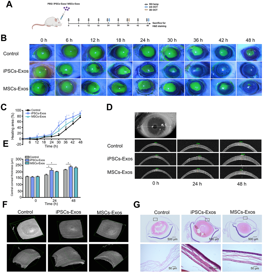 Effect of iPSCs/MSCs-Exos on corneal epithelial defect healing in vivo. (A) Schematic diagram of the experimental procedure. After corneal epithelial defect and treated with iPSCs/MSCs-Exos every 6 h, different procedures were performed at relative time point. (B) The corneal epithelial defect area was monitored every 6 hours with fluorescein staining and slit lamp. (C) The corneal epithelial defect healing rates are shown in line graphs. The cornea healing area in iPSCs-Exos group increased obviously compared with that in the vehicle group and was statistically significant at 12, 30, 36, 42, and 48 h compared with control group. (D) Central corneal thickness was measured by AS-OCT at both 24 and 48 h. (E) Central corneal thickness is shown by bar graph. Central corneal thickness in the iPSCs-Exos group was statistically different from that of the control. (F) A 3D-pattern was generated by AS-OCT for rat corneas at 36 h, enabling a more stereoscopic view of the corneal epithelial defects. (G) Rat eyeballs were harvested 48 h after corneal defect and were stained with hematoxylin and eosin. Data are representative of one of three independent experiments performed. Each experiment consisted of 4 animals/group. The values are shown as the mean ± SEM. * P