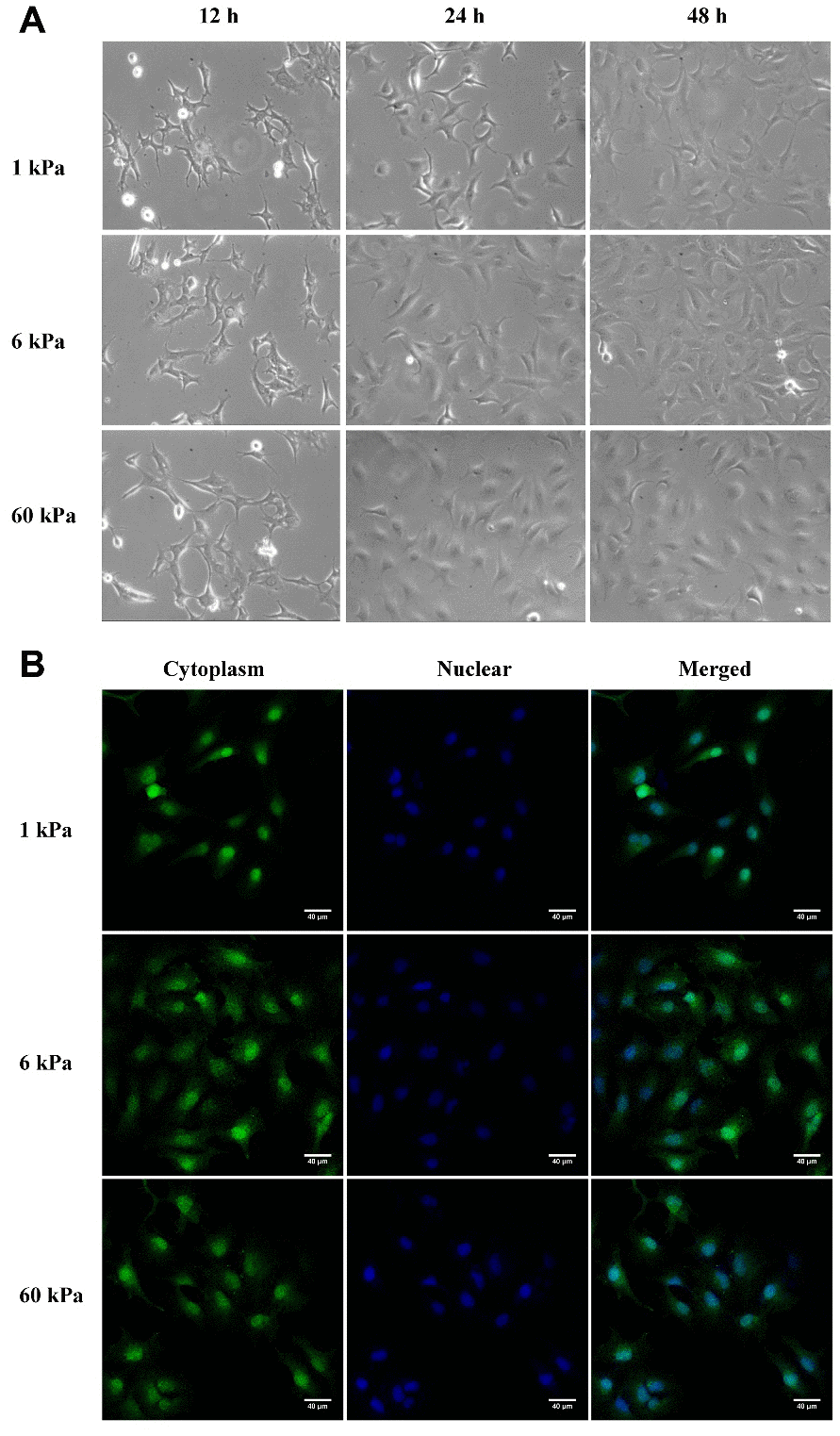 Cell morphology closely correlate with substrate rigidity. (A) Typical DIC images of SKOV-3 cultured on polyacrylamide hydrogels with different substrate rigidity. SKOV-3 cells were plated on collage I-coated 1 kPa, 6 kPa and 60 kPa hydrogels, and then images were taken at 12 h, 24 h or 48 h. (B) SKOV-3 cells plated on collage I-coated 1 kPa, 6 kPa and 60 kPa hydrogels for 24 h were fixed and stained with CellTracker fluorescent probes (left) and DAPI (middle) to visualize cytoplasm and nucleus respectively. Scale bar - 40 μm.