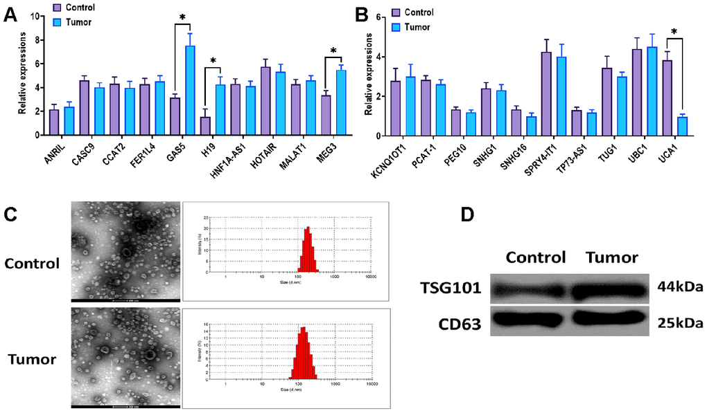 Expression of UCA1 in esophageal cancer tissues. (A, B) Expressions of candidate lncRNAs in esophageal cancer tissues (Tumor) and paired normal tissues (Control) (n=15). (C) Morphology and size of exosomes derived from the plasma of patients with esophageal cancer (Tumor) or control subjects (Control). Scale bar = 200 nm. (D) Protein expressions of exosomal markers TSG101 and CD63 in exosomes derived from the plasma of patients with esophageal cancer (Tumor) or control subjects (Control). (*) denotes the difference between groups (P