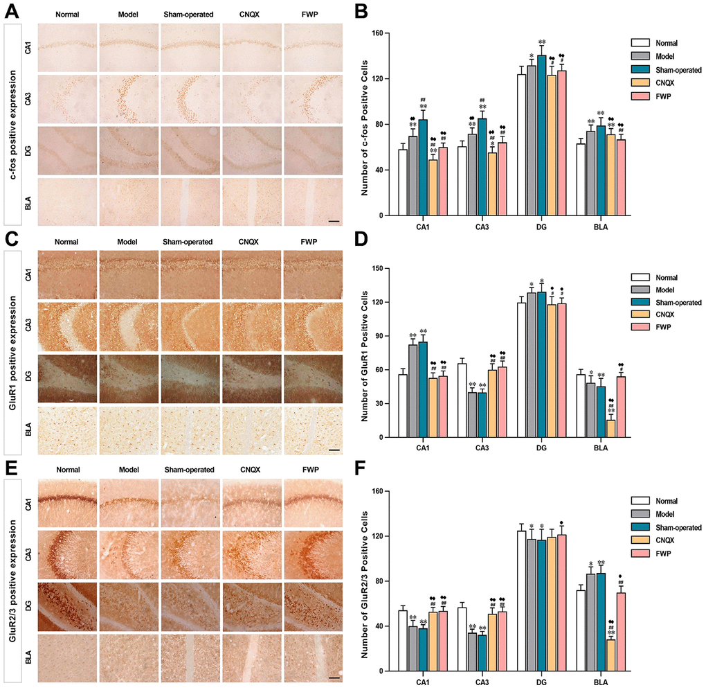 Effects of FWP on c-Fos, GluR1 and GluR2/3 expression in hippocampus CA1, CA3 and DG, and amygdala BLA, in depressive rats with liver-depression and spleen-deficiency syndrome (×400, scale bar = 200 μm). (A, B) The positive expression and positive cell of c-Fos; (C, D) The positive expression and positive cell of GluR1; (E, F) The positive expression and positive cell of GluR2/3. Results are presented as mean ± SD from 25 sections. *PP#P##P♦P♦♦P