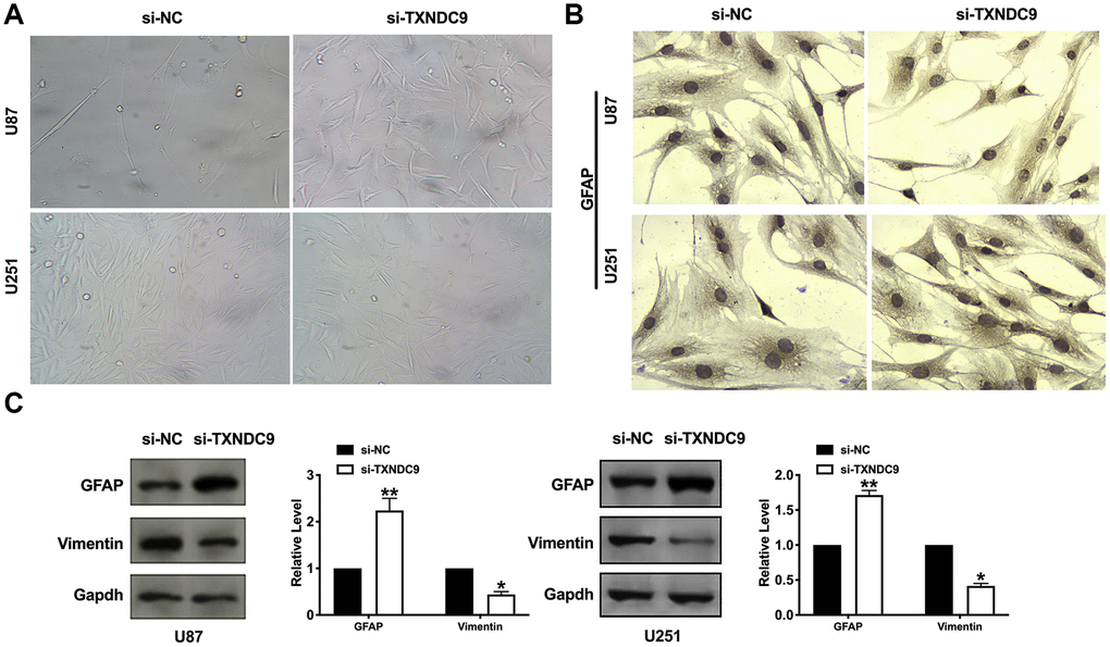 Knockdown of TXNDC9 induced differentiation of glioma cells. (A) U87 cell morphology was scanned after transfecting with si-TXNDC9/si-NC. (B) The immunocytochemical assay was performed for GFAP expression. (C). The protein level of vimentin and GFAP were measured in U87 and U251 cells, Gapdh was indicated as a loading control. n= 6, *PP