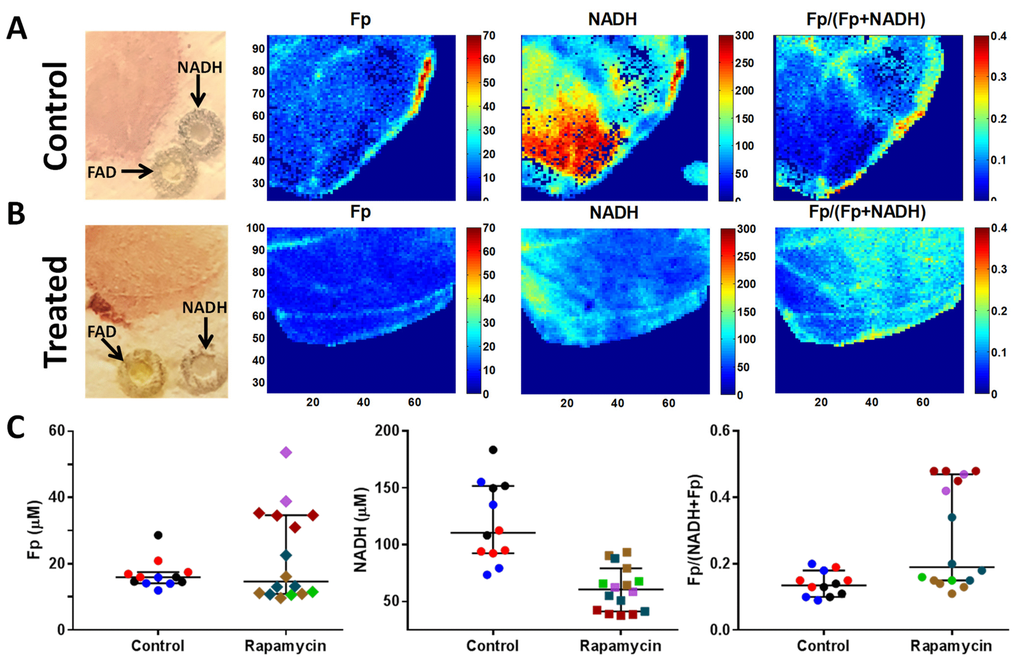 Optical redox imaging of old mouse muscles. (A, B) Representative white light and redox images of one layer of a quadriceps specimen from control (A) and treated (B) groups. The in-plane spatial resolution of the redox images is 100 μm. The concentrations of Fp and NADH are nominal concentrations in reference to the embedded flavin adenine dinucleotide (FAD) and NADH standards, respectively. The color bars for Fp and NADH images are nominal concentrations in reference to the embedded standards, respectively, and that for the redox ratio image ranges from 0-0.4. (C) Scattered plots of redox indices (Fp, NADH, and the redox ratio) for all specimens comparing control and treated groups. Each dot is a mean value for a specific redox index of a tissue layer and the tissue layers from the same tissue specimen are encoded with the same color (bars: median with 95% CI).