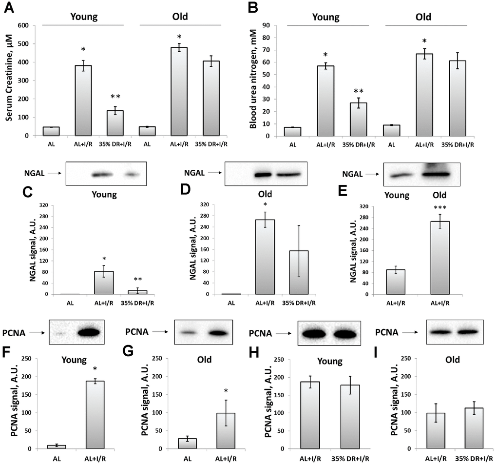 Assessment of renal function after I/R in young and old rats with or without DR exposure. (A) The severity of AKI evaluated by serum creatinine levels 48 h after I/R; (B) The severity of AKI evaluated by blood urea nitrogen levels in serum 48 h after I/R; (C) The renal tissue injury evaluated by NGAL levels in urine 24 h after I/R in young rats; (D) The renal tissue injury evaluated by NGAL levels in urine 24 h after I/R in old rats; (E) The comparison of NGAL levels in the urine of young and old rats 24 h after I/R; (F, G) The increase of proliferation evaluated by PCNA levels in kidney tissue 48 h after I/R in young and old rats; (H, I) PCNA levels in kidney tissue 48 h after I/R in young and old rats exposed to DR diet. *p 