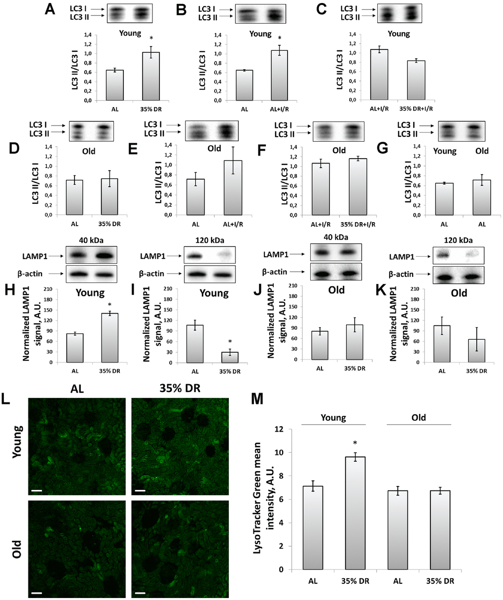 Assessment of autophagic activity in young and old rats. (A) LC3 II/LC3 I ratio in kidney tissue of young rats in response to DR; (B) LC3 II/LC3 I ratio in kidney tissue of young rats in response to I/R; (C) The comparison of LC3 II/LC3 I ratio in kidney tissue of young rats after I/R with or without DR diet; (D) LC3 II/LC3 I ratio in kidney tissue of old rats in response to DR; (E) LC3 II/LC3 I ratio in kidney tissue of old rats in response to I/R; (F) The comparison of LC3 II/LC3 I ratio in kidney tissue of old rats after I/R with or without DR diet; (G) Comparison of LC3 II/LC3 I ratio in kidney tissue of young and old rats; (H, I) Levels of non-glycosylated (40 kDa) and glycosylated (120 kDa) forms of LAMP1 in kidney tissue of young rats; (J, K) Levels of non-glycosylated (40 kDa) and glycosylated (120 kDa) forms of LAMP1 in kidney tissue of old rats; (L) Lysosomes staining with LysoTracker Green probe revealed by confocal microscopy of vital kidney slices. Scale bar, 100 μm; (M) Quantification of LysoTracker Green fluorescence intensity. *p 