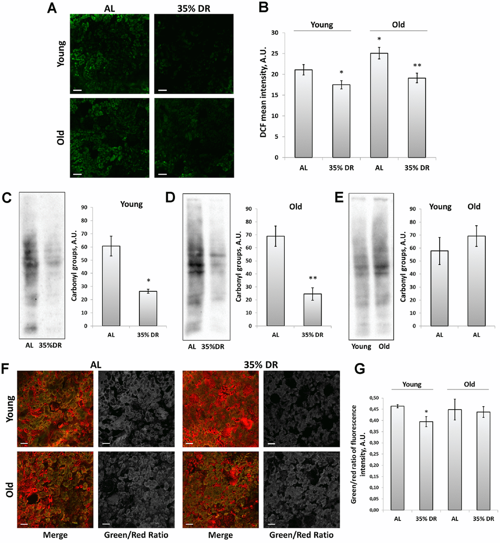 ROS production and oxidative stress in the kidney. (A) Confocal microscopy of DCF-loaded vital kidney slices. Scale bar, 100 μm; (B) Quantification of DCF fluorescence intensity on confocal images; (C) OxyBlot staining for carbonylated proteins in kidney tissue of young DR rats; (D) OxyBlot staining for carbonylated proteins in kidney tissue of old rats after DR; (E) Comparison of carbonylated protein levels in kidney tissue of young and old rats; (F) Confocal microscopy of vital kidney slices stained with Lipid Peroxidation Kit. Scale bar, 100 μm; (G) Estimation of lipid peroxidation measured by a green/red ratio of fluorescence intensity. *p 