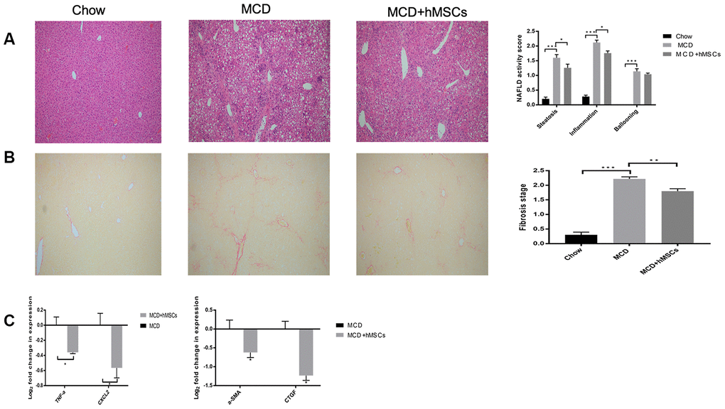 Human mesenchymal stem cells alleviated hepatic steatosis, inflammation, and fibrosis induced by MCD diet. (A) Representative images of HE-stained liver sections of the three groups. Steatosis, ballooning, and inflammation in the liver of the three groups were scored according to the NAFLD activity scoring system. (B) Representative images of Sirius Red-stained liver sections of the indicated groups. The fibrosis stages were evaluated according to the NAFLD activity score. (C) Relative mRNA levels of inflammatory cytokines (TNF-a and CXCL-2) and indicators of hepatic fibrosis (a-SMA and CTGF) from the MCD and MCD+hMSCs groups. * P 