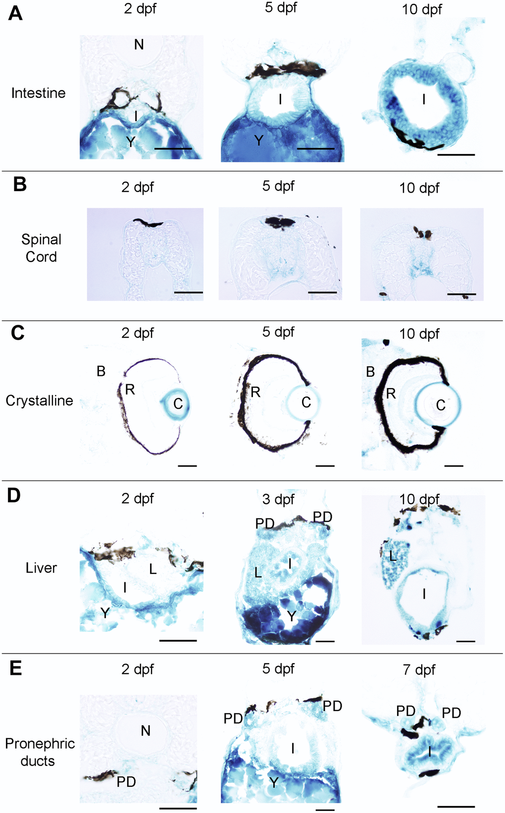 Photomicrographs of transverse sections of developing zebrafish showing the presence of SA–β–gal staining in different organs. (A) Photomicrographs showing the presence of SA–β–gal staining in the rostral part of the intestine. (B) Photomicrographs showing the presence of SA–β–gal staining in the spinal cord. (C) Photomicrographs showing the presence of strong SA–β–gal staining in the outer layer of the crystalline and weak SA–β–gal staining in the brain. (D) Photomicrographs showing the presence of SA–β–gal staining in the liver. Note that the intensity of staining in the liver is weaker in 2 dpf animals. (E) Photomicrographs showing the presence of SA–β–gal staining in the pronephric ducts. Note that the intensity of staining in the pronephric duct is weaker in 2 dpf animals. Dorsal is to the top in all sections. Abbreviations: B: brain, C: crystalline, I: intestine, N: notochord, L: liver, PD: pronephric ducts, R: retina, Y: yolk. Scale bars: 50 μm.