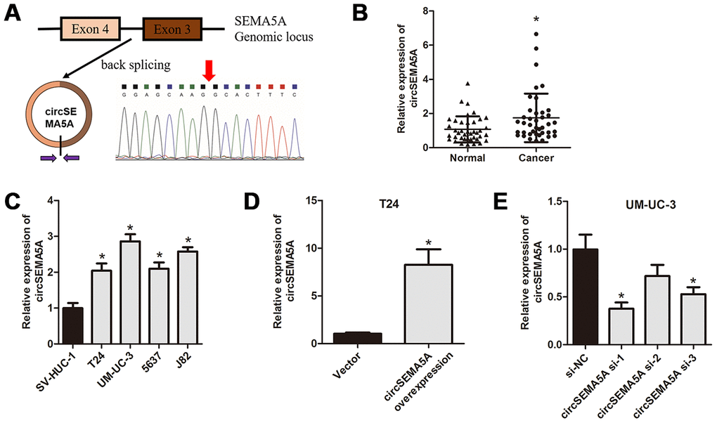 circSEMA5A is upregulated in BC. (A) Diagram showed the circSEMA5A derived from exons 3 and 4 of SEMA5A gene. The back-splicing junction site of circSEMA5A was confirmed by PCR amplification and followed by Sanger sequencing. (B) The relative expression of circSEMA5A was detected by qRT-PCR in BC tissues and paired normal bladder tissues. (C) The relative expression of circSEMA5A was detected by qRT-PCR in BC cell lines and a normal human uroepithelial cell line. (D and E) The transfection efficiencies were verified by qRT-PCR when T24 cells were transfected with circSEMA5A overexpression plasmids and UM-UC-3 cells were transfected with circSEMA5A siRNAs. Data are presented as mean ± SD. *P 