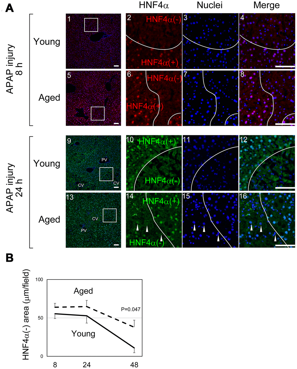 Liver tissue damage is sustained in aged mice. (A) Hepatocytes around CVs lose HNF4α. HNF4α is thoroughly and exclusively expressed in hepatocytes in the adult liver. Both in young and aged livers, hepatocytes around CVs that are damaged by APAP lose nuclear HNF4α, whereas hepatocytes outside the damaged tissue thoroughly express HNF4α. Bars represent 100 μm. (B) Quantification of the HNF4α region. The damaged areas containing HNF4α- hepatocytes occupy approximately 50% of liver tissue at 8 and 24 hours after APAP administration in both young and aged mice. However, HNFα- areas are greatly reduced in young but not in aged mice at 48 hours. Average values with SEMs are presented in the graph.