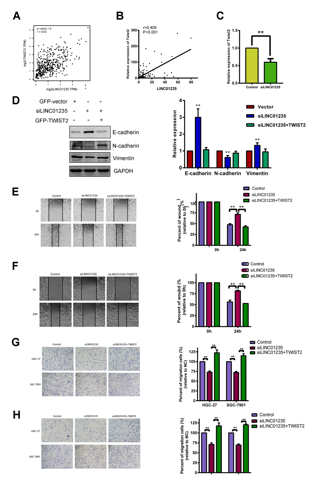 LINC01235 depletion downregulates TWIST2 expression. (A) Predicted correlation between LINC01235 and TWIST2 in the TCGA gastric cancer data set. (B) RT-qPCR shows correlations between LINC01235 and TWIST2 expression in 48 additional GC tissues. (C) RT-qPCR shows TWIST2 expression in control- and siLINC01235-HGC-27 cells. (D) Western blot shows effects of ectopic TWIST2 on expression of EMT-related genes in control- and siLINC01235-HGC-27 cells. (E and F) Wound-healing percentages in control, siLINC01235, and siLINC01235+TWIST2 groups. (G and H) Transwell assay of HGC-27 and SGC-7901 cells shows effects of LINC01235 and TWIST2 on migration and invasion. Results are expressed as means ± SD. **: P 